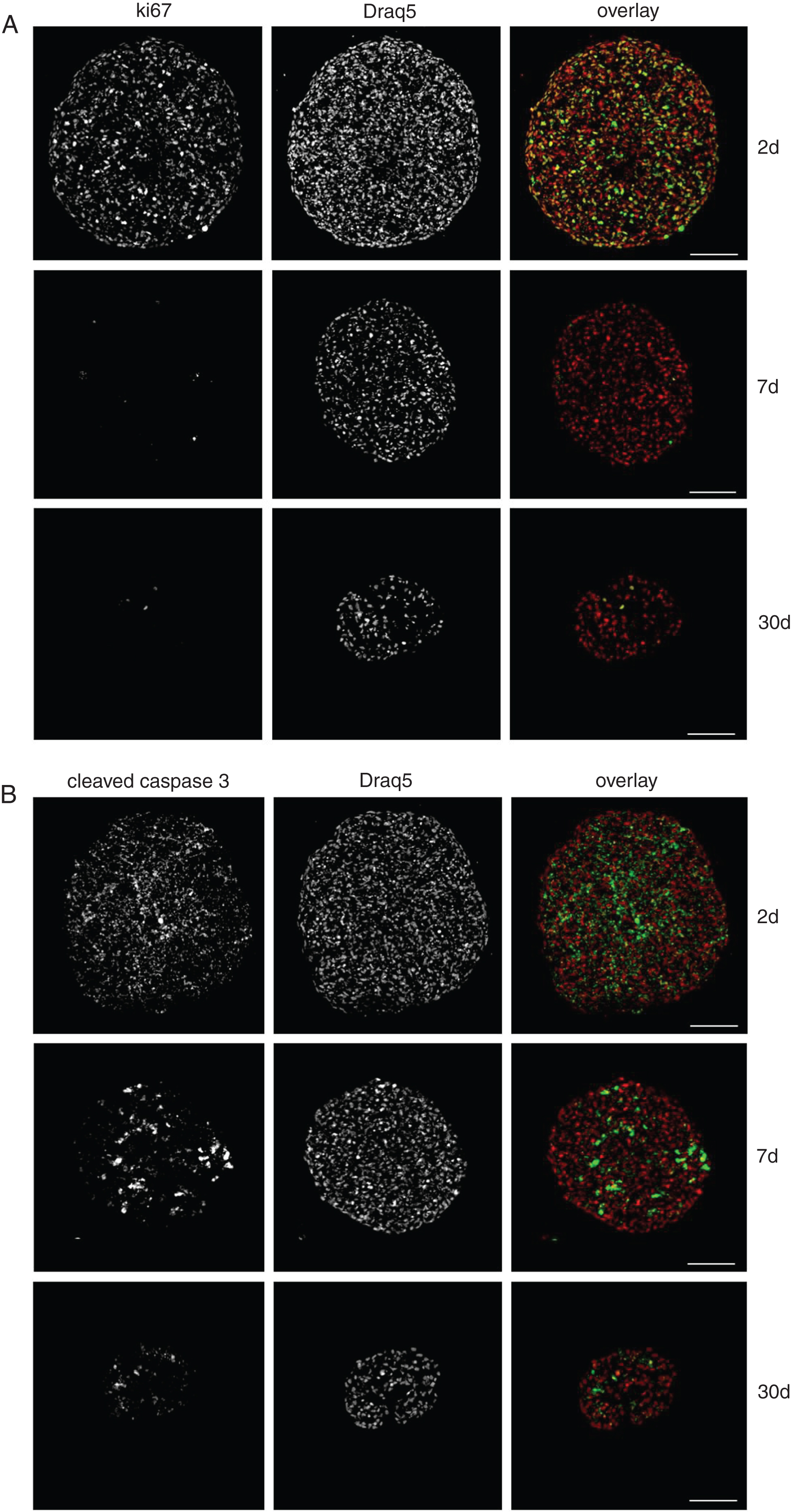  Phenotypic analysis of HaCaT spheroids. HaCaT cells were grown as spheroids. After 2, 7, and 30 days, spheroids were sectioned into 10-μm thick slices and immunostained for Ki67 (A) or Cleaved caspase 3 (B), respectively. Nuclei were labeled with Draq5. Scale bars, 100 μm. Ki67 is a well-known marker to differentiate between dividing and postmitotic cells [102]. This is found within the nucleus during G1, S and G2, while in mitosis it is bound to dividing chromosomes. At G0 it is not present at all [100]. Caspase 3 is a major executioner caspase in all types of apoptosis. Its prodomain is cleaved upon apoptosis induction thereby activating its function that leads to the execution of apoptotic cell death [102, 104, 105].