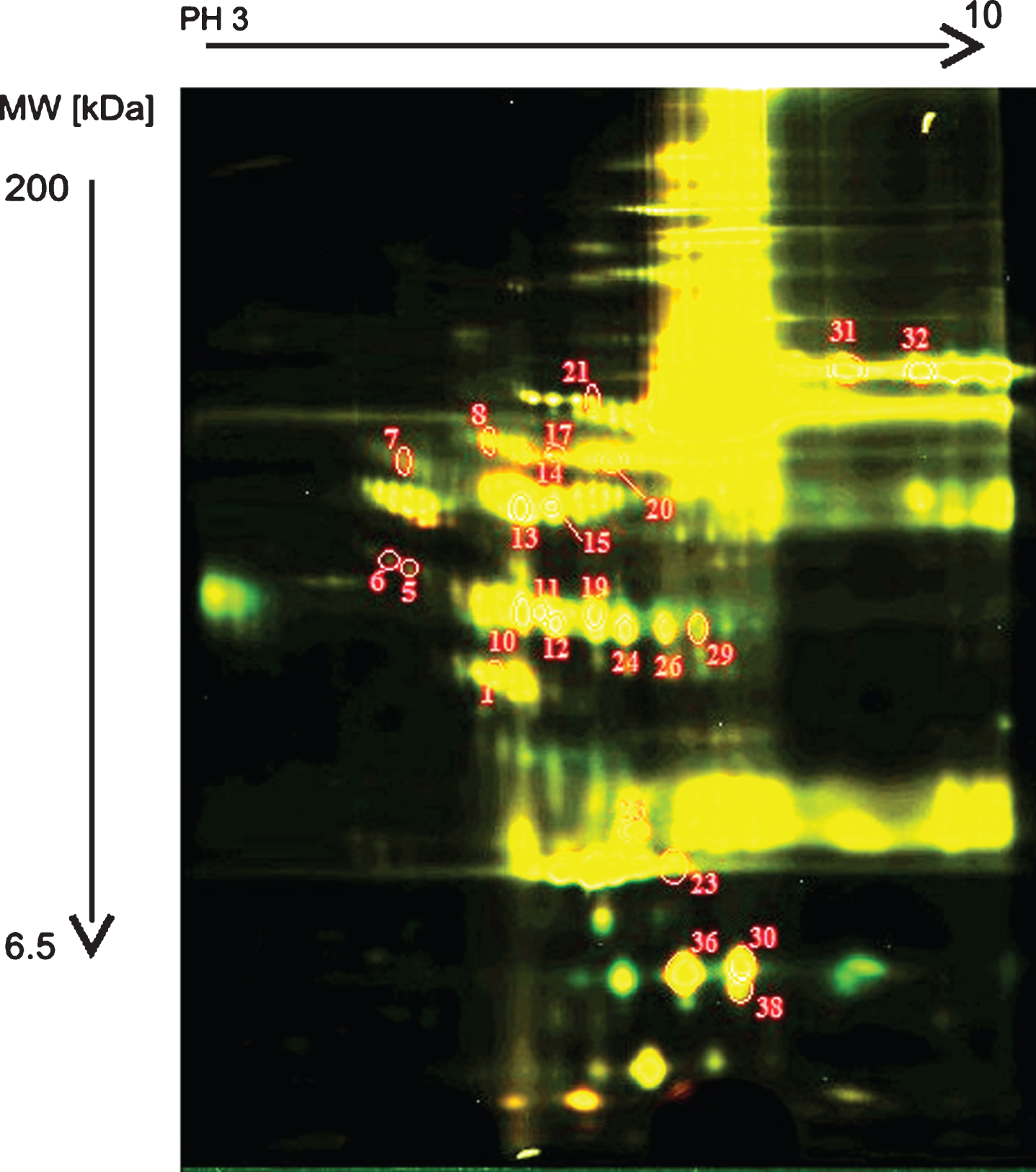 The scanned image of the gel, obtained by two-dimensional electrophoresis and differential fluorescent staining with Cy3 Protein Labeling Kit and Cy5 Protein Labeling Kit (Jena Bioscience). The results of the comparison of the groups I – II. (Group I: blood plasma of D2TM patients with complications. Group II: blood plasma of diabetic patients without complications.)