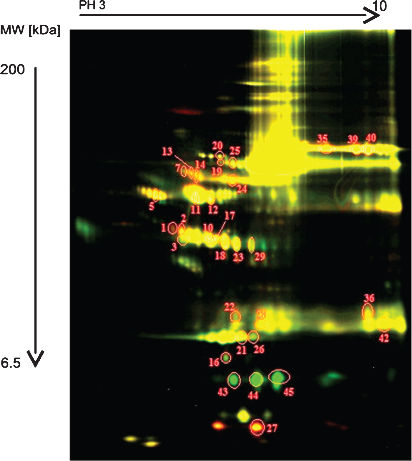 The scanned image of the gel, obtained by two-dimensional electrophoresis and differential fluorescent staining with Cy3 Protein Labeling Kit and Cy5 Protein Labeling Kit (Jena Bioscience). The results from the comparison of the groups I – III. [Group I: blood plasma of patients with D2TM with complications. Group III: blood plasma of clinically healthy individuals (healthy controls)].