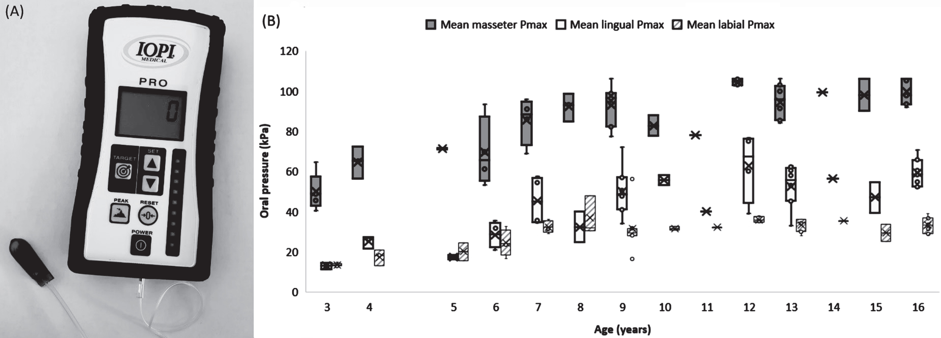 Iowa oral performance instrument (A) and boxplot representation of the maximal mean oral pressures (Pmax) as a function of age in the control group (n = 53) (B). Boxplot extremes represent the lowest and highest values of the sample. The lowest and highest part of the box represent the first and third quartiles, respectively. The crosses and bars represent the mean and median values of the samples. The age groups with only one patient are represented in the form of a “star” with 6 points.