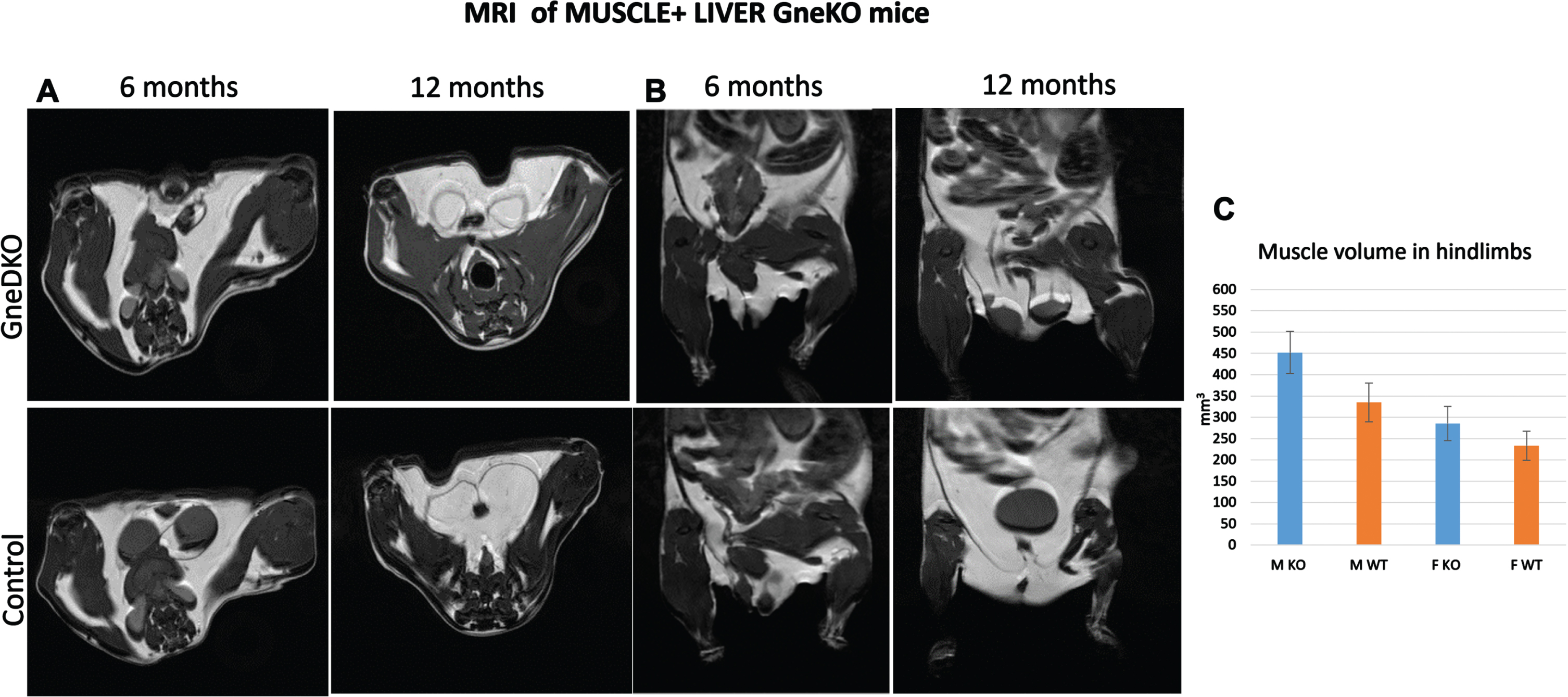 Muscle MRI. Representative figures of axial (A) and coronal planes (B) of Gne double tissue KO mice and controls. C, quantitation of the total hindlimb muscle volume (M, males; F, females).