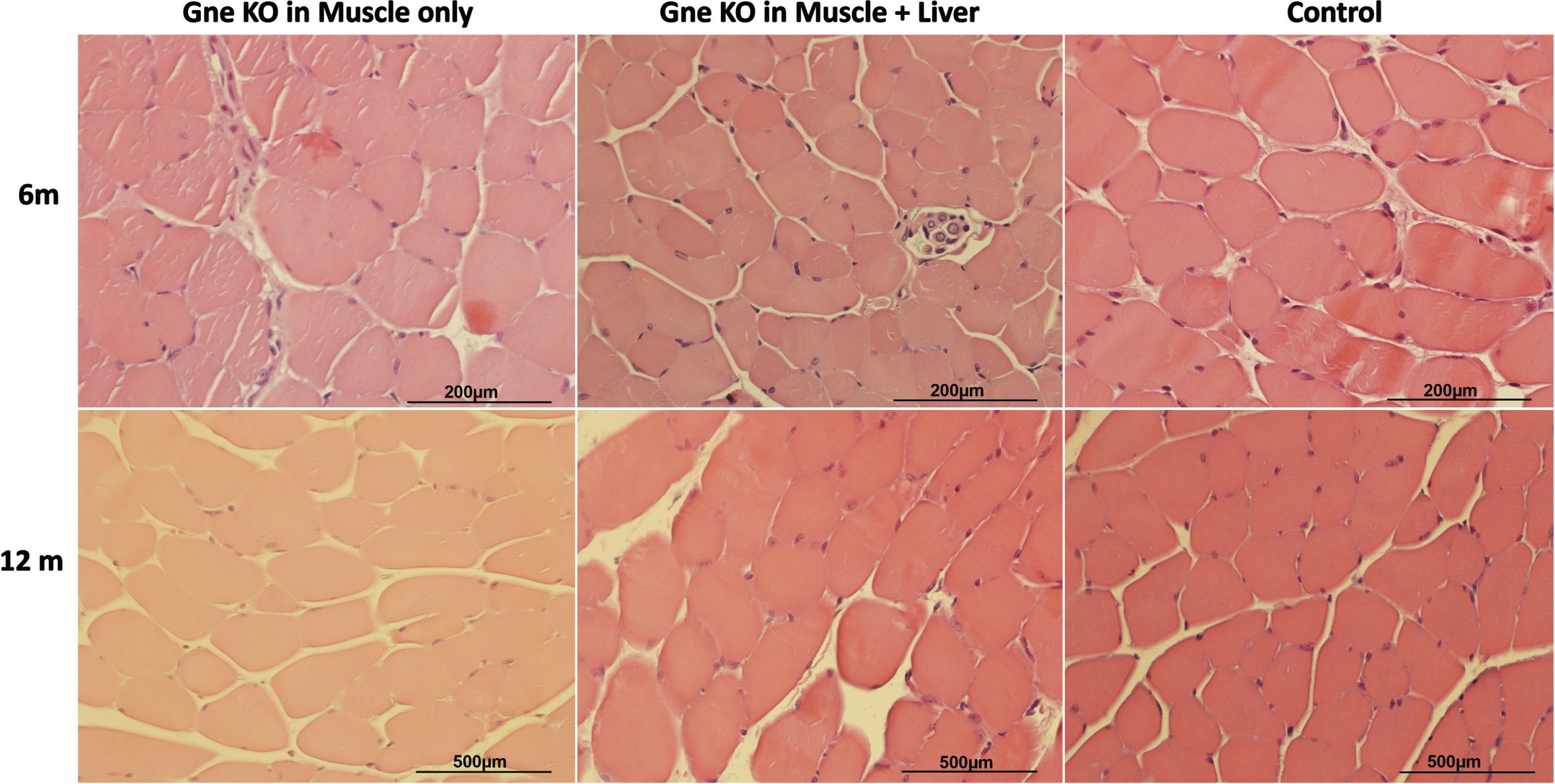 Muscle Histological Sections. Representative H&E tibialis anterior histological sections of muscle Gne KO, muscle+liver Gne double KO and control mice 6 and 12 months after GneKO was effective.