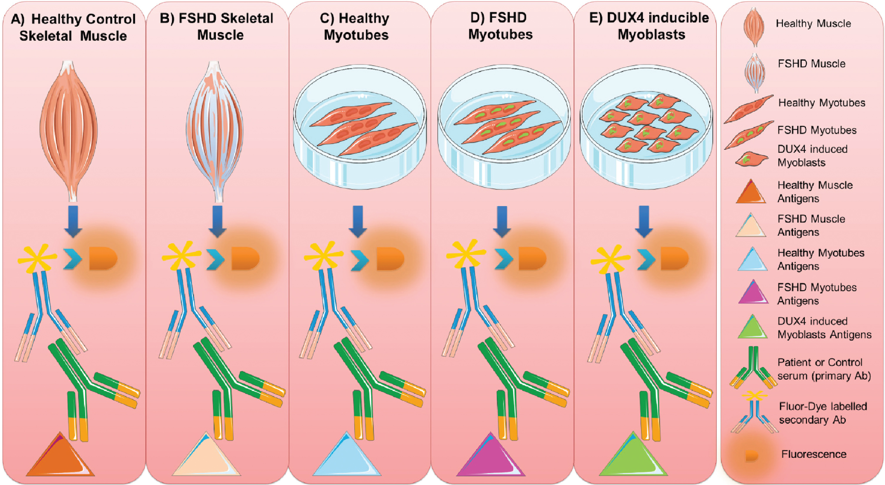 Muscle antigen preparations. Protein extracts were prepared from healthy control (A) and FSHD (B) skeletal muscle biopsies, from cultured healthy (C) and FSHD myotubes (D) and from DUX4-expressing myoblasts (E). The reactivity of FSHD and HC sera with each of these extracts was analyzed by immunoblotting. This figure was created adapting Servier Medical Art templates. Original images are licensed under a Creative Commons Attribution 3.0 Unported License.