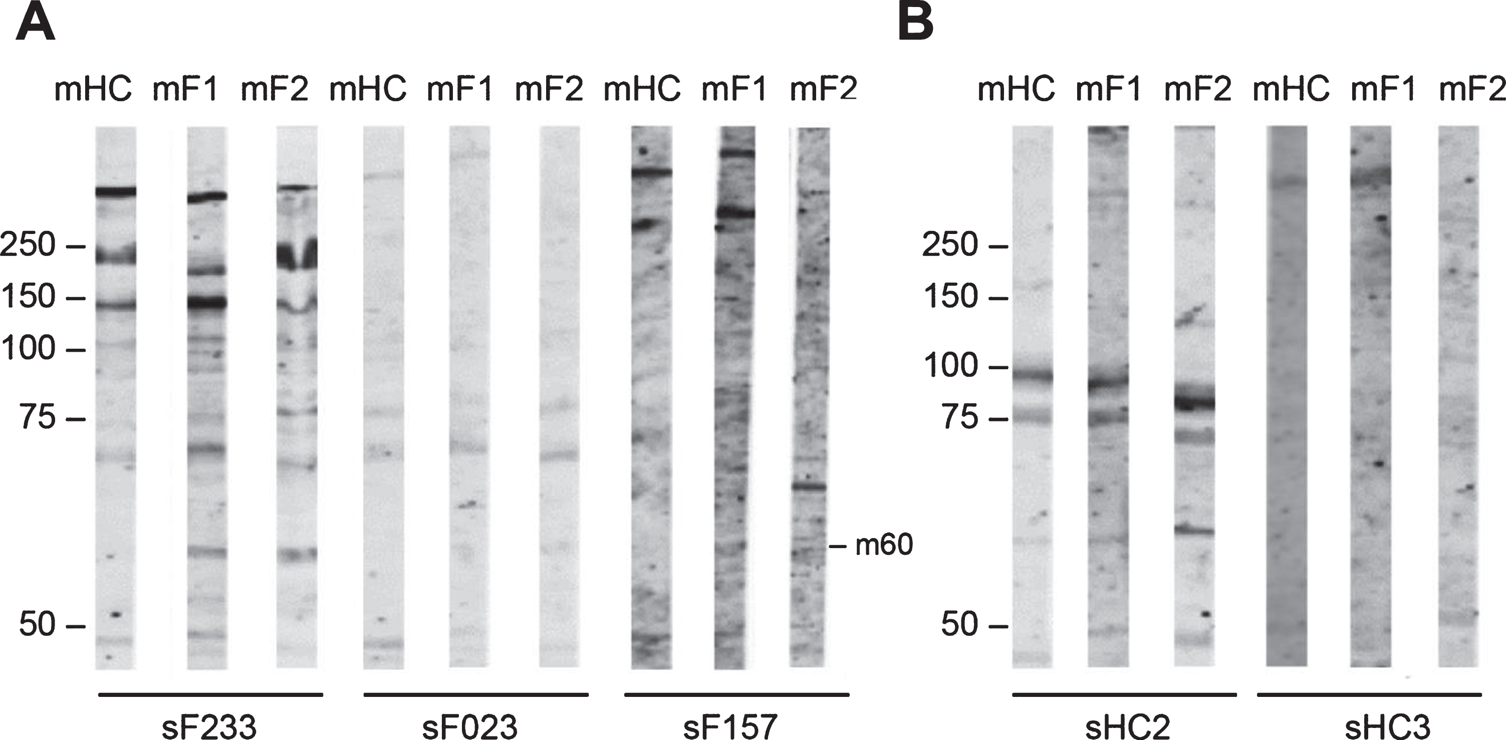 Reactivity of FSHD patient sera and HC sera with FSHD myotubes protein extract. FSHD1 myotubes protein extract (mF1), FSHD2 myotubes protein extract (mF2), and healthy myotubes protein extract (mHC) were separated by SDS-PAGE and transferred to nitrocellulose membranes. Blot strips were incubated with 49 FSHD patient sera (sF) (A) and with 3 healthy control sera (sHC) (B). Panels contain a representative set of tested samples. On the left of each panel the positions of molecular weight markers are indicated.