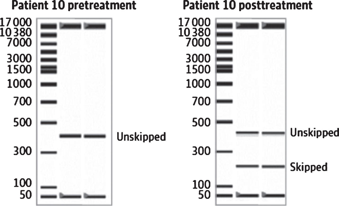 Example of an RNA blot showing viltolarsen-induced exon skipping in DMD participant muscle. From Clemens et al. 2020 [40].