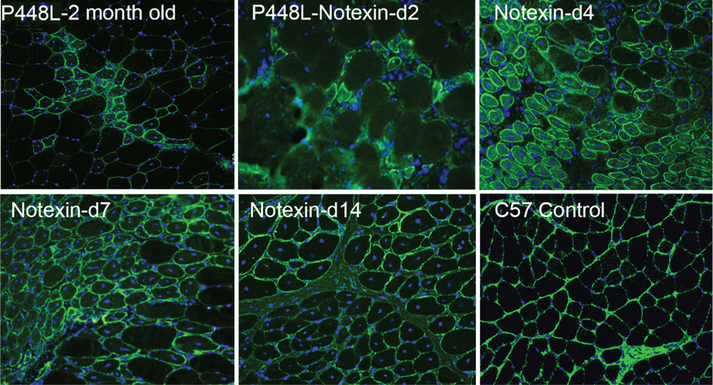 Revertant fibers in muscles of P448L FKRP mutant mice (Upper left) and restoration of matriglycan expression in the regenerating muscle fibers after Notexin induced damage from day 2 to day 14 (d2-d14). Matriglycan (green) is detected with primary monoclonal antibody IIH6 (EMD Millipore) (1:500) and detected with secondary Alexa Fluor 488 goat anti-mouse (Invitrogen) and nuclei (blue) are stained with DAPI.