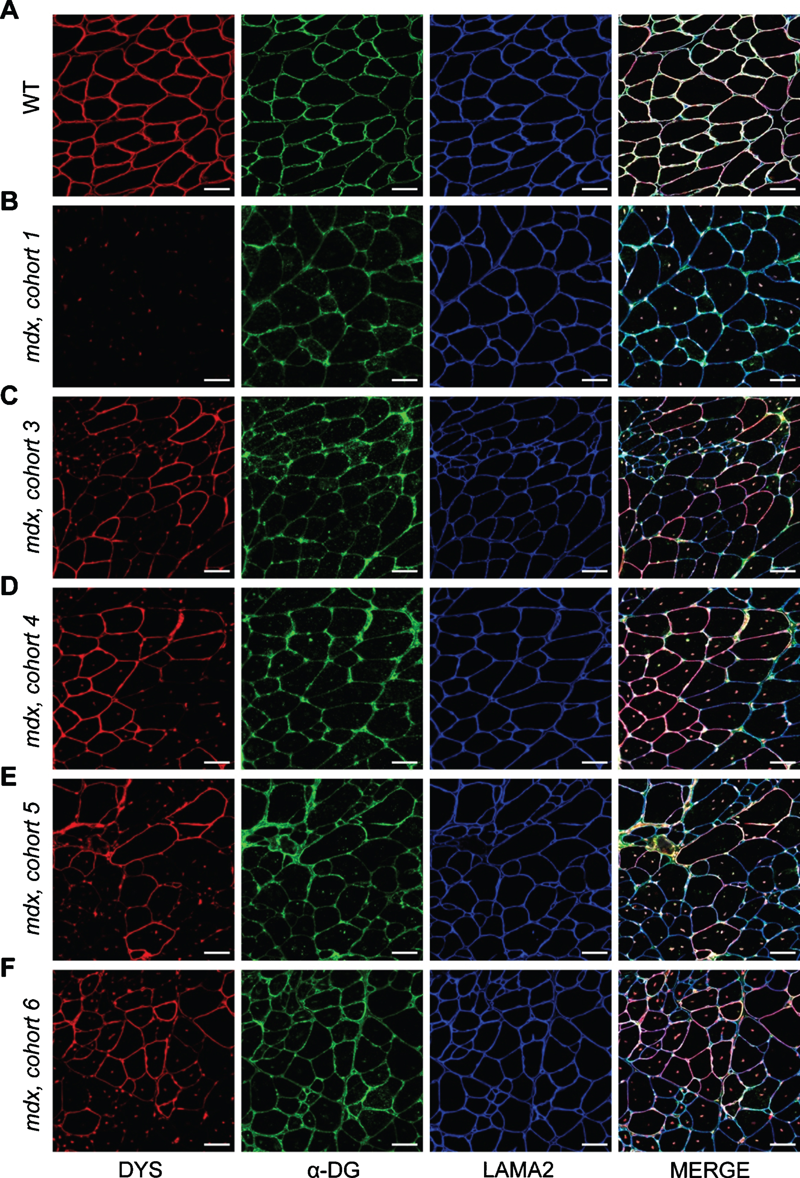 Localization of DGC proteins after dystrophin-restoring therapy. A–F) Co-mmunolabeling of dystrophin (DYS, red), α-dystroglycan (α-DG, green), laminin-α2 (LAMA2, blue) to assess protein localization in areas of dystrophin restoration after therapy. Immunostaining was performed on WT muscle (A), control/untreated mdx muscle from mdx cohort 1 (B), and PMO-treated mdx muscles from mdx cohorts 3–6 (C–F, respectively). Merged panels show dystrophin, α-dystroglycan, and laminin-α2 localization with DAPI-labeled nuclei. Scale bars represent 50μm.