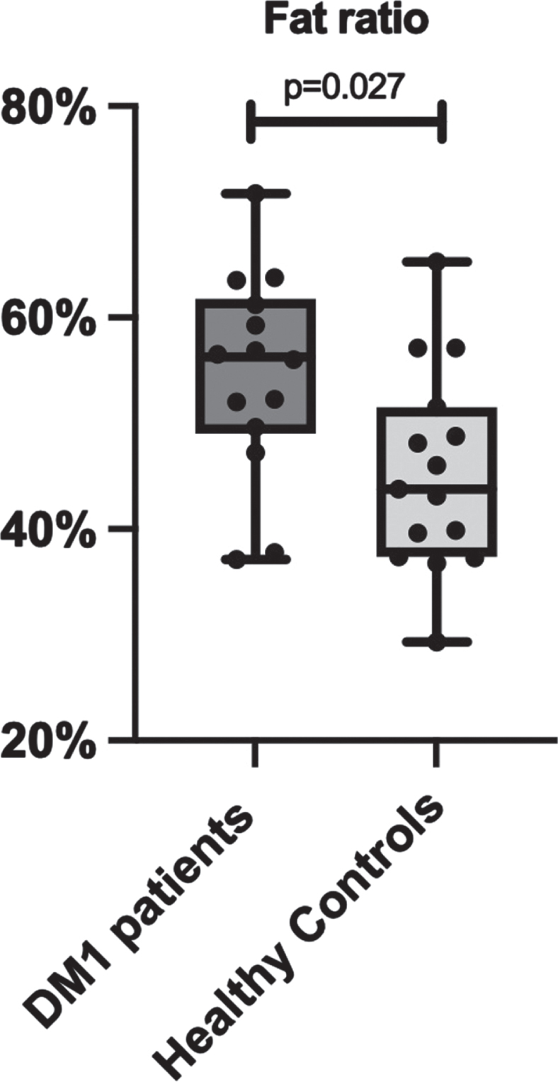 Comparison of fat ratio between myotonic dystrophy type 1 (DM1) patients and healthy age-, sex- and BMI-matched controls, based on full-body MRI measurements.