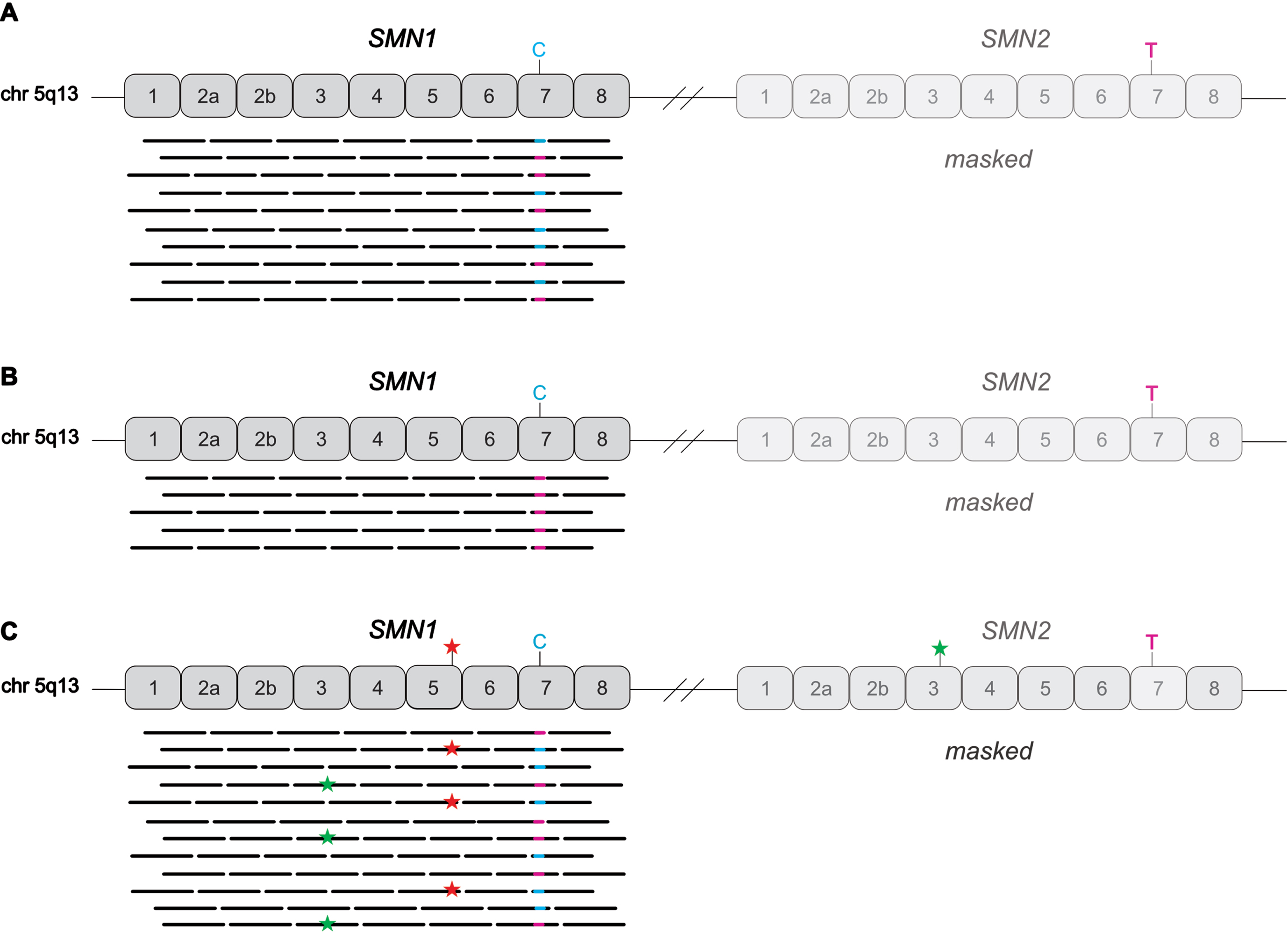 Schematic representation of the SMN1/2 locus on chromosome 5q. SMN1 and SMN2 genes differ in the “Gene-determining variant” (GDV) NM_000344.4:c.840C>T p.(Phe280=) (rs1164325688) in exon 7, depicted as C (blue) in SMN1 and T (red) in SMN2. By masking of SMN2 in the reference genome, all SMN1/2 reads are mapped to SMN1. SMN1 can be analyzed for SNVs by the caller. (A) Example of a normal control: The T (GDV of SMN2) is called in a VAF of <0.9 indicating absence of a homozygous deletion of exon 7 of SMN1. (B) Example of a patient with a homozygous SMN1 deletion: There are no reads with the C (SMN1). Thus, the variant caller indicates T (GDV of SMN2) with a VAF of >0.9 (“homozygous”). (C) Example of a patient with a pathogenic SNV in SMN1 (indicated as red star) and a benign variant in SMN2 (indicated as green star). After applying the SMN2-masked pipeline, SNVs in SMN1 as well SMN2 reads are called. It has to be considered that the assumed diploid sequence for the variant calling is not anymore true and is at least doubled or even more tripled resulting in variant allele frequencies (VAF) ≠ 0.5 for heterozygous variants. The VAF depends on the SMN1 and SMN2 copy number of the individual. A heterozygous SNV in oneSMN1copy may have a low VAF (e.g. of 0.2 in case of two SMN1 and three SMN2 copies).