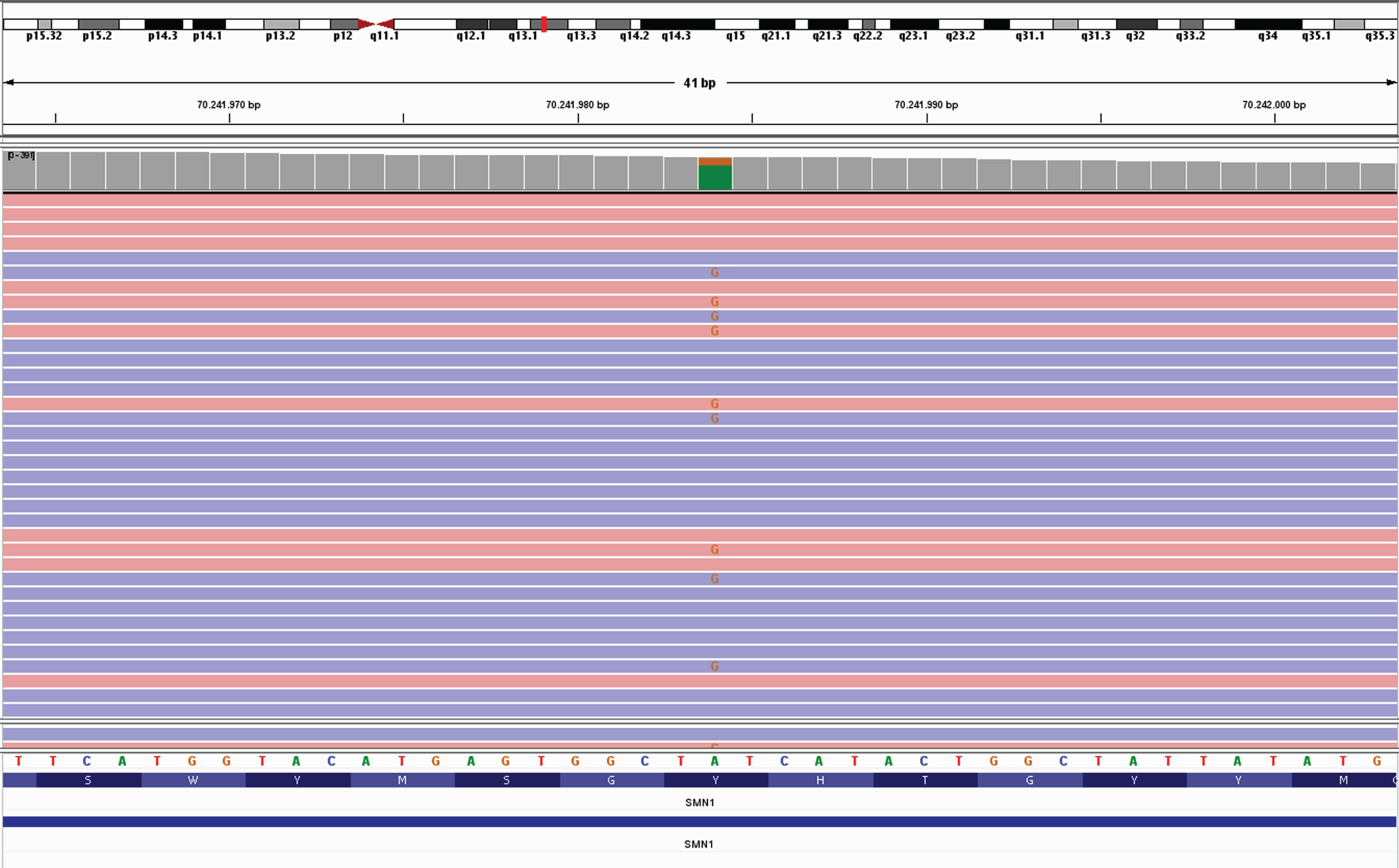 Example of a heterozygous pathogenic variant in SMN1, NM_000344.4:c.815A>G p.(Tyr272Cys) in the IGV (Integrative Genomics Viewer (27)).