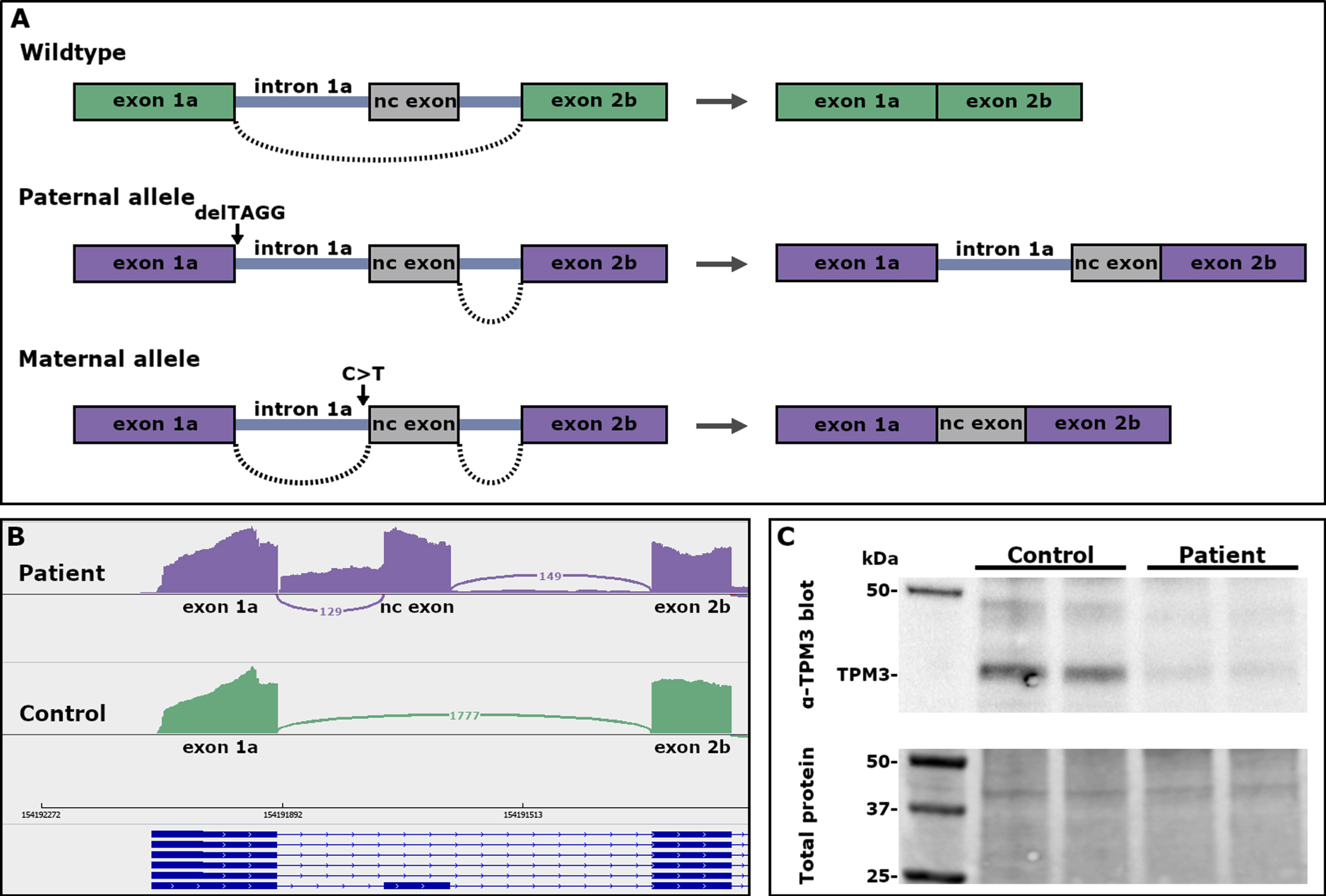 (A) A schematic representation of the effect of the TPM3 variants on pre-mRNA splicing. (B) Sashimi plots showing the splicing pattern in the 5’end of TPM3. Inclusion of intron 1a and a non-coding exon in transcripts from myotubes of the patient, and normal splicing of exon 1a to exon 2b in control myotubes. (C) Western blot showing low expression of TPM3 in myoblasts from the patient.