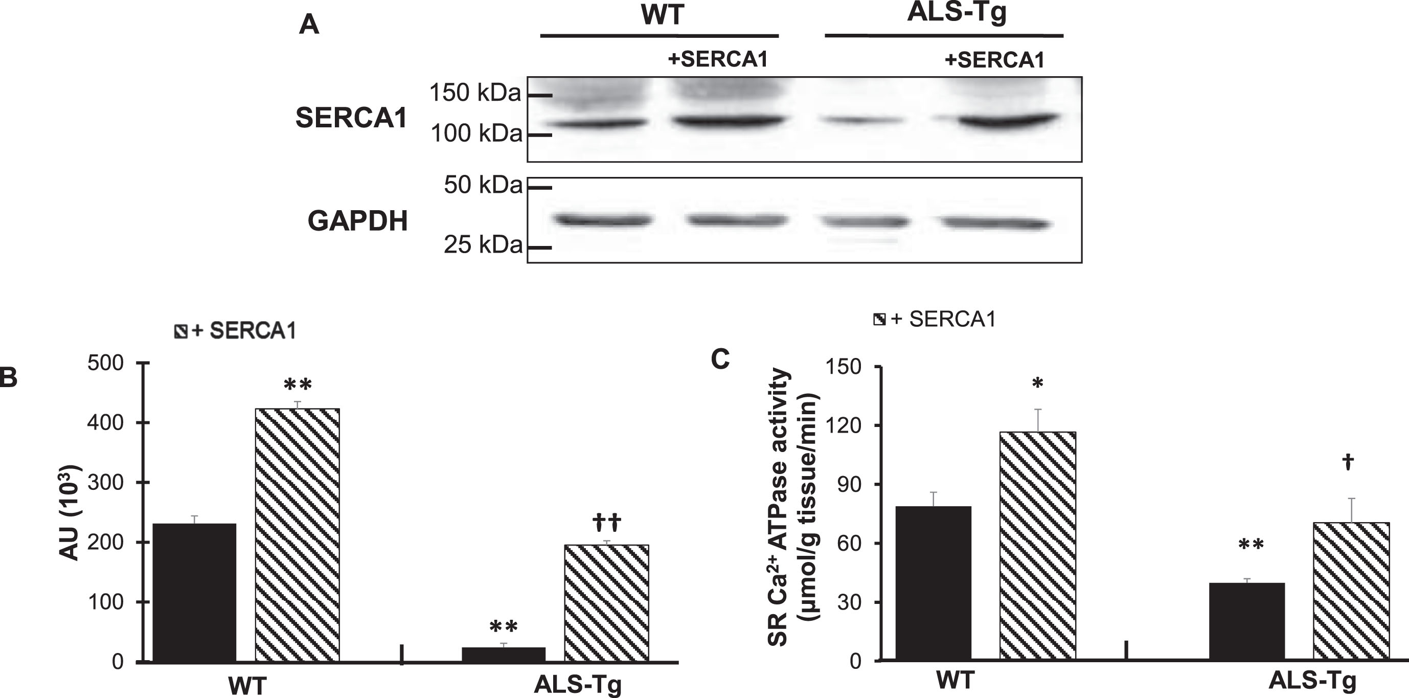 SERCA1 overexpression increases SERCA1 protein levels and maximal SR Ca2+-ATPase activity in quadriceps muscles in WT and ALS-Tg mice. A) Representative western blot image for SERCA1 protein level in quadriceps (QUAD) muscle from WT and ALS-Tg mice with and without SERCA1 overexpression. B) Quantitative analysis of western blot images by densitometry. Data shown are in arbitrary units (AU) for WT (n = 4; 1 male and 3 female), WT/+SERCA1 (n = 4; 1 male and 3 female), ALS-Tg (n = 4; 1 male and 3 female) and ALS-Tg/+SERCA1 (n = 4; 1 male and 3 female). C) Maximal SR Ca2+-ATPase activity of QUAD muscle of WT (n = 4), WT/+SERCA1 (n = 4), ALS-Tg (n = 4) and ALS-Tg/+SERCA1 (n = 4). Average data (B, C) represent mean±SEM. *p < 0.05 vs. WT, **p < 0.01 vs. WT, †p < 0.05 vs. ALS-Tg, ††p < 0.01 vs. ALS-Tg.