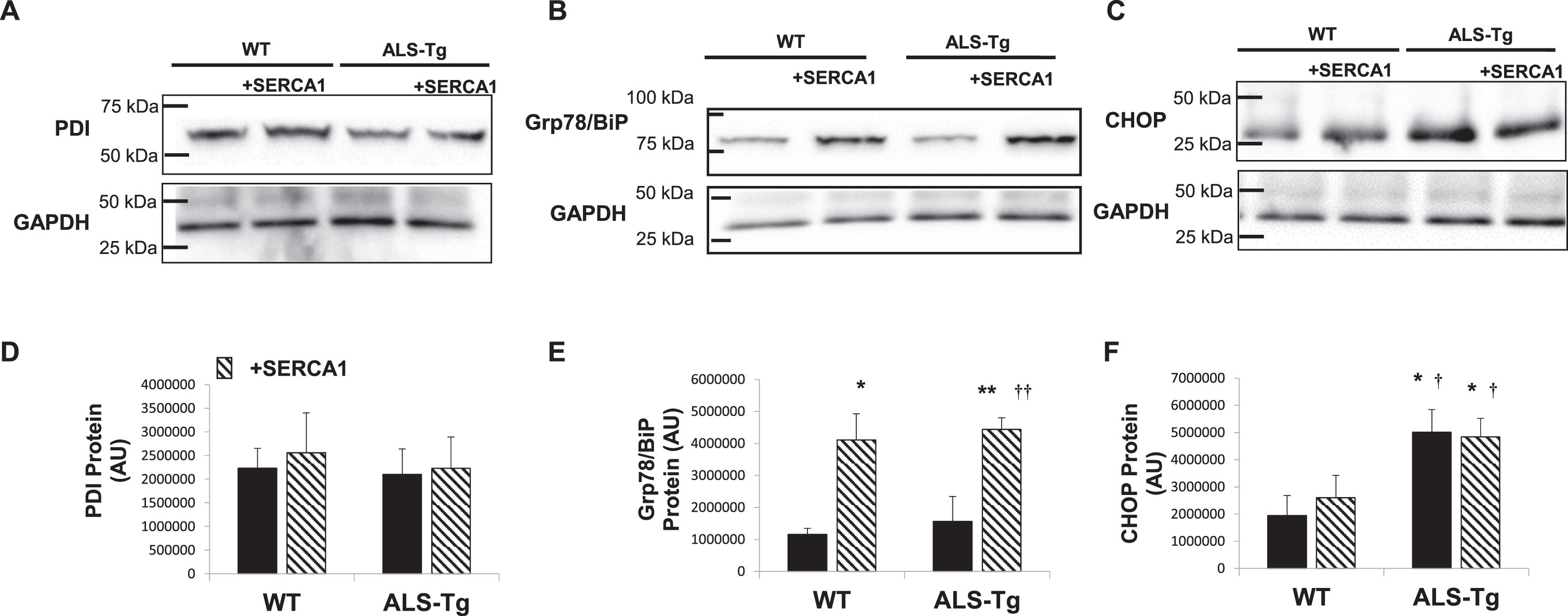 Proteins of the unfolded protein and ER stress response pathways in in skeletal muscle of WT, ALS-Tg and SERCA1 overexpressing mice. A-C) Representative western blot images for protein disulfide isomerase (PDI) (A), Grp78/BiP (B) and ER stress-specific cell death signaling protein C/EBP homologous protein (CHOP) (C) in QUAD muscle from WT and ALS-Tg mice with and without SERCA1 overexpression. D–F) Quantitative analysis of western blot images by densitometry for PDI (D), Grp78/BiP (E) and CHOP (F). Data shown are in arbitrary units (AU) for WT (n = 4; 1 male and 3 female), WT/+SERCA1 (n = 4; 1 male and 3 female), ALS-Tg (n = 4; 1 male and 3 female) and ALS-Tg/+SERCA1 (n = 4; 1 male and 3 female). Average data (D–F) represent mean±SEM. *p < 0.05 vs. WT, **p < 0.01 vs. WT; †p < 0.05 or ††p < 0.01 vs. ALS-Tg.