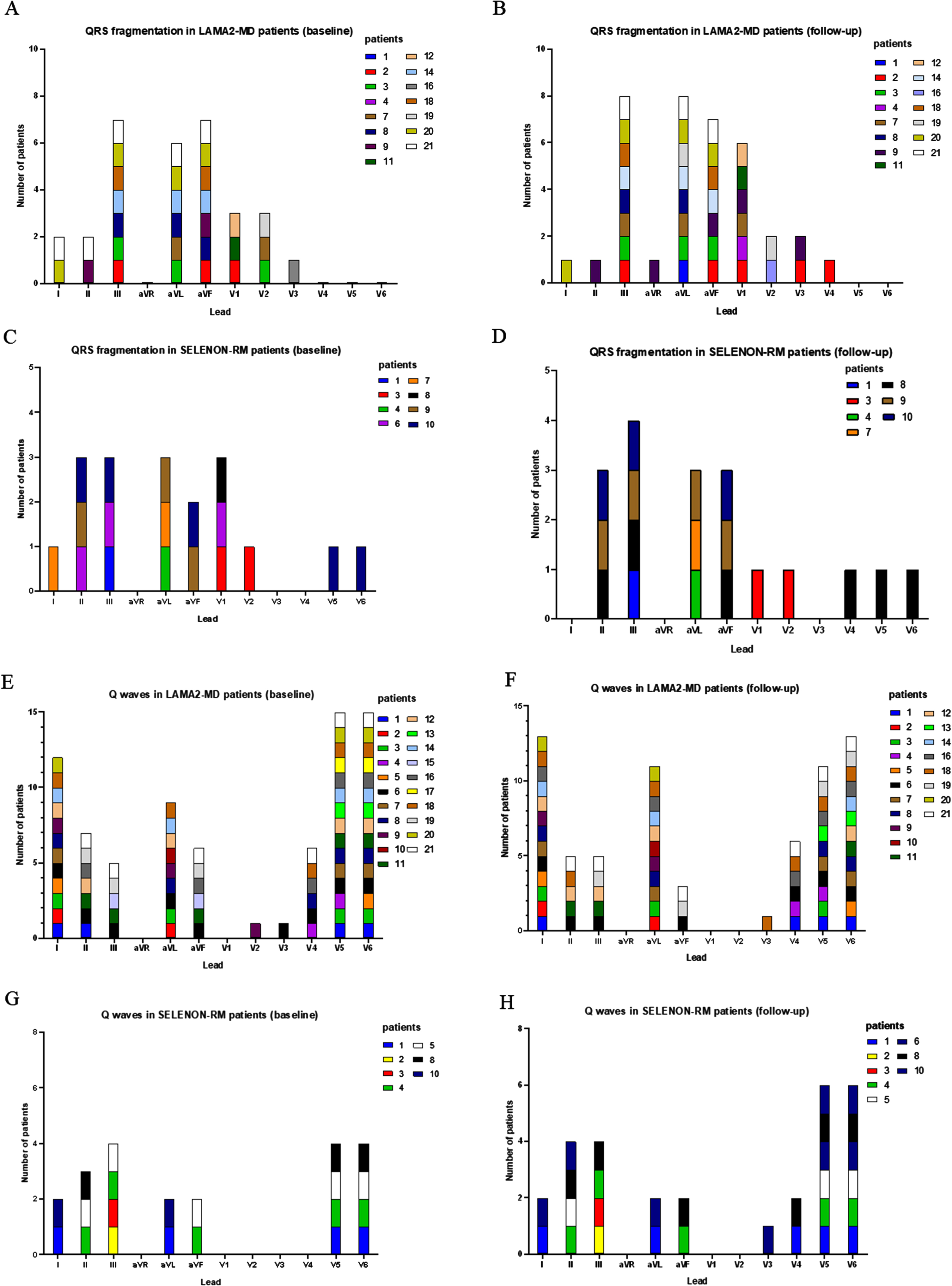 QRS fragmentation and Q waves per lead in LAMA2-MD and SELENON-RM patients at baseline and follow-up. (A) number of LAMA2-MD patients with QRS fragmentation per lead at baseline; total n = 21. (B) number of LAMA2-MD patients with QRS fragmentation per lead at follow-up; total n = 19. (C) number of SELENON-RM patients with QRS fragmentation per lead at baseline; total n = 10. (D) number of SELENON-RM patients with QRS fragmentation per lead at follow-up; total n = 10. (E) number of LAMA2-MD patients with Q waves per lead at baseline; total n = 21. (F) number of LAMA2-MD patients with Q waves per lead at follow-up; total n = 19. (G) number of SELENON-RM patients with Q waves per lead at baseline; total n = 10. (H) number of SELENON-RM patients with Q waves per lead at follow-up; total n = 10. LAMA2-MD = LAMA2-related muscular dystrophy; SELENON-RM = SELENON-related congenital myopathy.