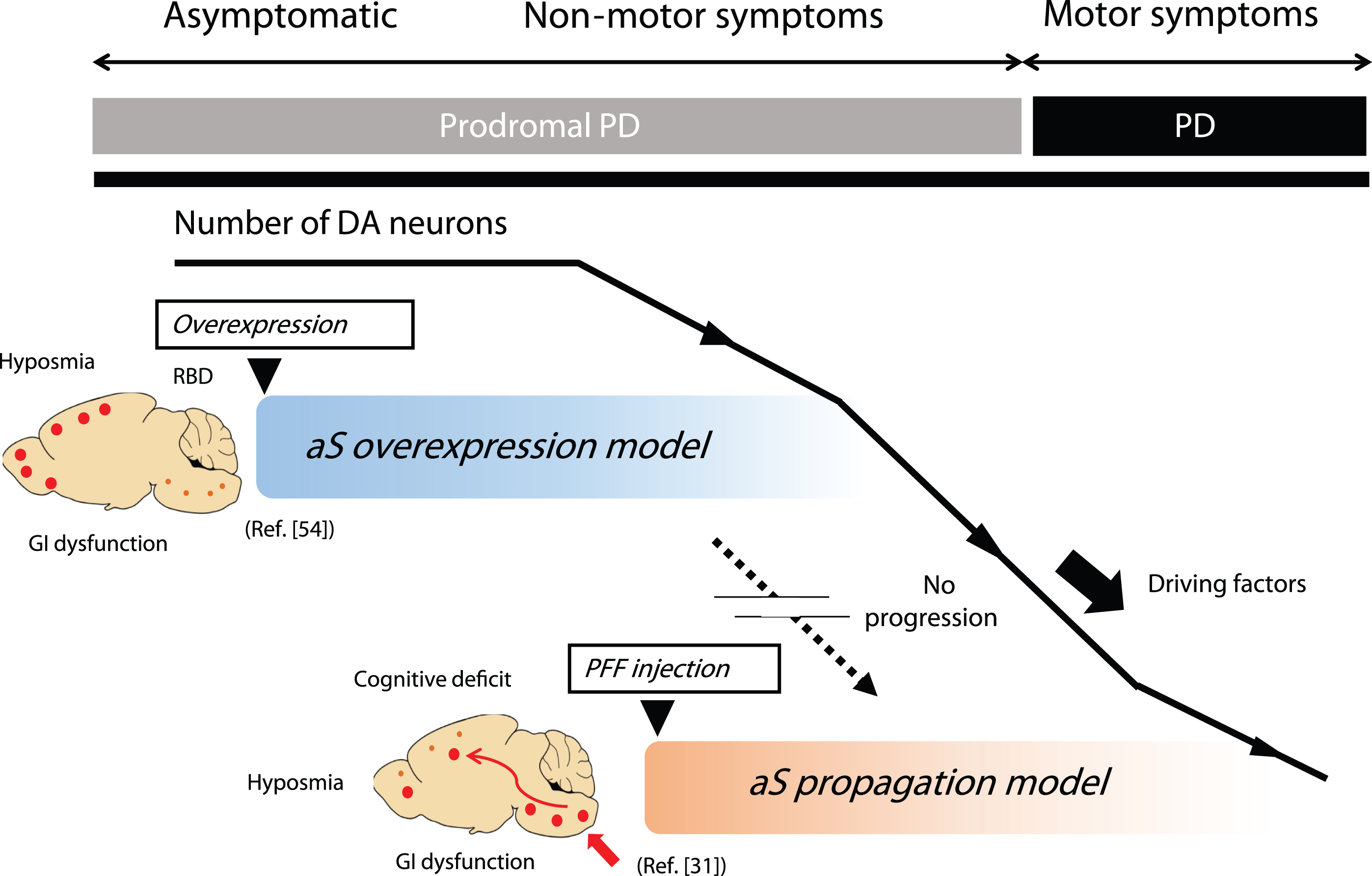 Representative animal models of prodromal PD. The genetic model represented by the aS overexpression model focuses on disease onset but fails to show motor symptoms associated with DA cell loss. While most successful aS propagation models exhibit robust propagation and DA cell loss, they often skip the critical initial step of aS aggregate formation. Thus, the entire natural course of the disease, from the prodromal to the symptomatic phase, is not fully replicated by a single animal model. This limitation is one of the drawbacks as a preclinical model for DMT, targeting the inhibition of progression from the prodromal to symptomatic phase of PD. aS, alpha-synuclein; DA, dopamine; GI, gastrointestinal; PD, Parkinson’s disease; PFF, preformed fibrils; RBD, REM sleep behavior disorder.