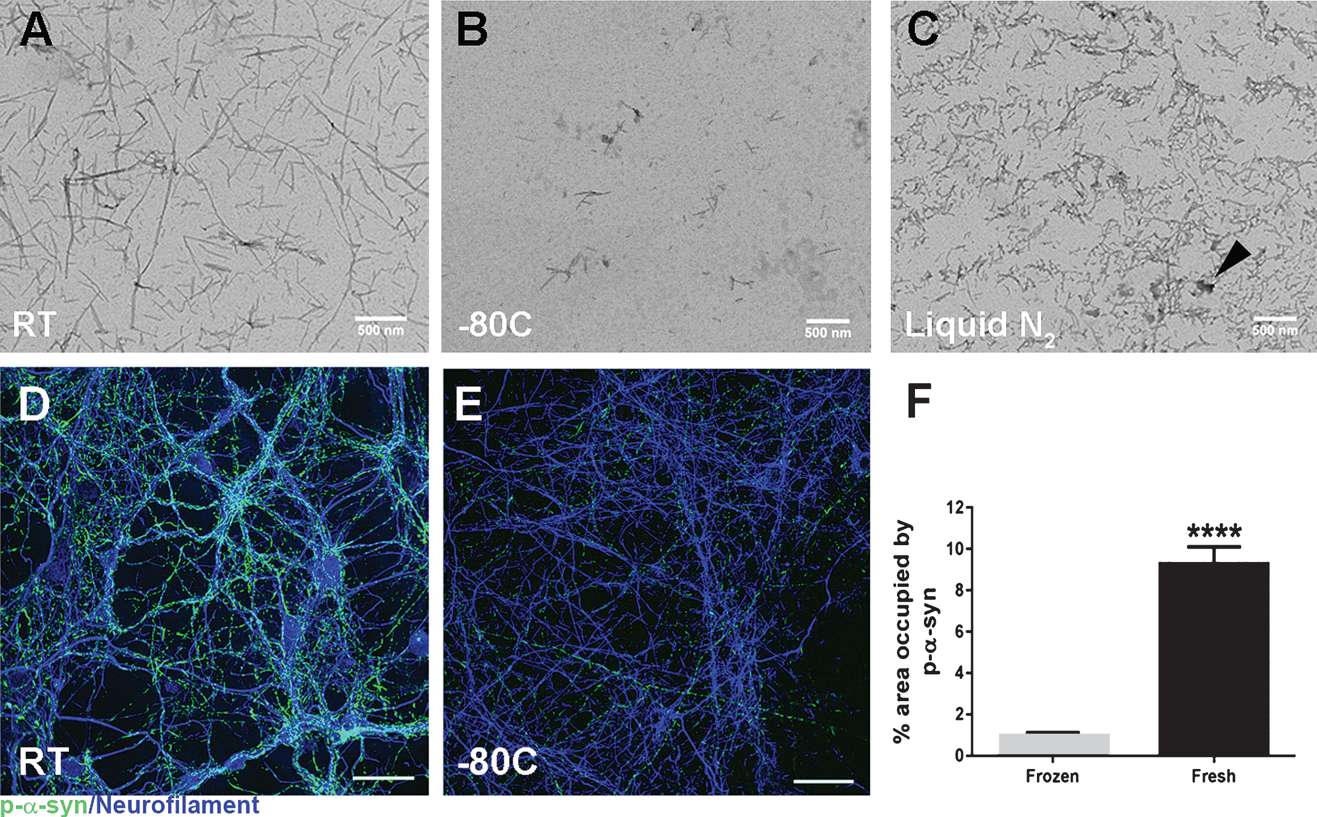 Impact of storage conditions on alpha-synuclein pre-formed fibril (aSyn PFF) structure and pathogenicity. A-C) Representative transmission electron microscopy (TEM) images of aSyn PFF samples stored at varying temperatures before sonication. A) Samples stored at room temperature for 3–4 weeks display long fibrillar structures characteristic of unsonicated aSyn PFFs. B) Samples stored at –80°C for 4–5 months display long fibril structures as well as fractured, smaller aggregates. C) Samples stored in liquid nitrogen for 4–5 months display a distinct morphology characterized by fractured fibrils and non-specific aggregates (arrowhead). D–F) Analysis of the impact of storage conditions on aSyn PFF pathogenicity in primary hippocampal neuron cultures. Primary hippocampal neurons were exposed to fibrils at 0.2 μg/mL and fixed 6 days later. D–E) Immunofluorescence was performed using an antibody to pS129 aSyn to visualize inclusions (green) or to neurofilament heavy chain (blue) to visualize axons. Scale bars = 50 μm. Fibrils were either (D) generated immediately before adding to primary neurons or (E) stored at –80°C for 6 months before use. F) Quantitation of the percent area occupied by pS129 aSyn immunoreactivity reveals a highly significant (p < 0.001) difference between fresh and frozen aSyn PFFs, with much greater levels of pS129 aSyn induced by fresh aSyn PFFs as compared to frozen aSyn PFFs. Graph depicts mean values with error bars denoting standard deviation. aSyn, alpha-synuclein; PFF, pre-formed fibril; RT, room temperature; liquid N2, liquid nitrogen; p-α-syn, pS129 aSyn.