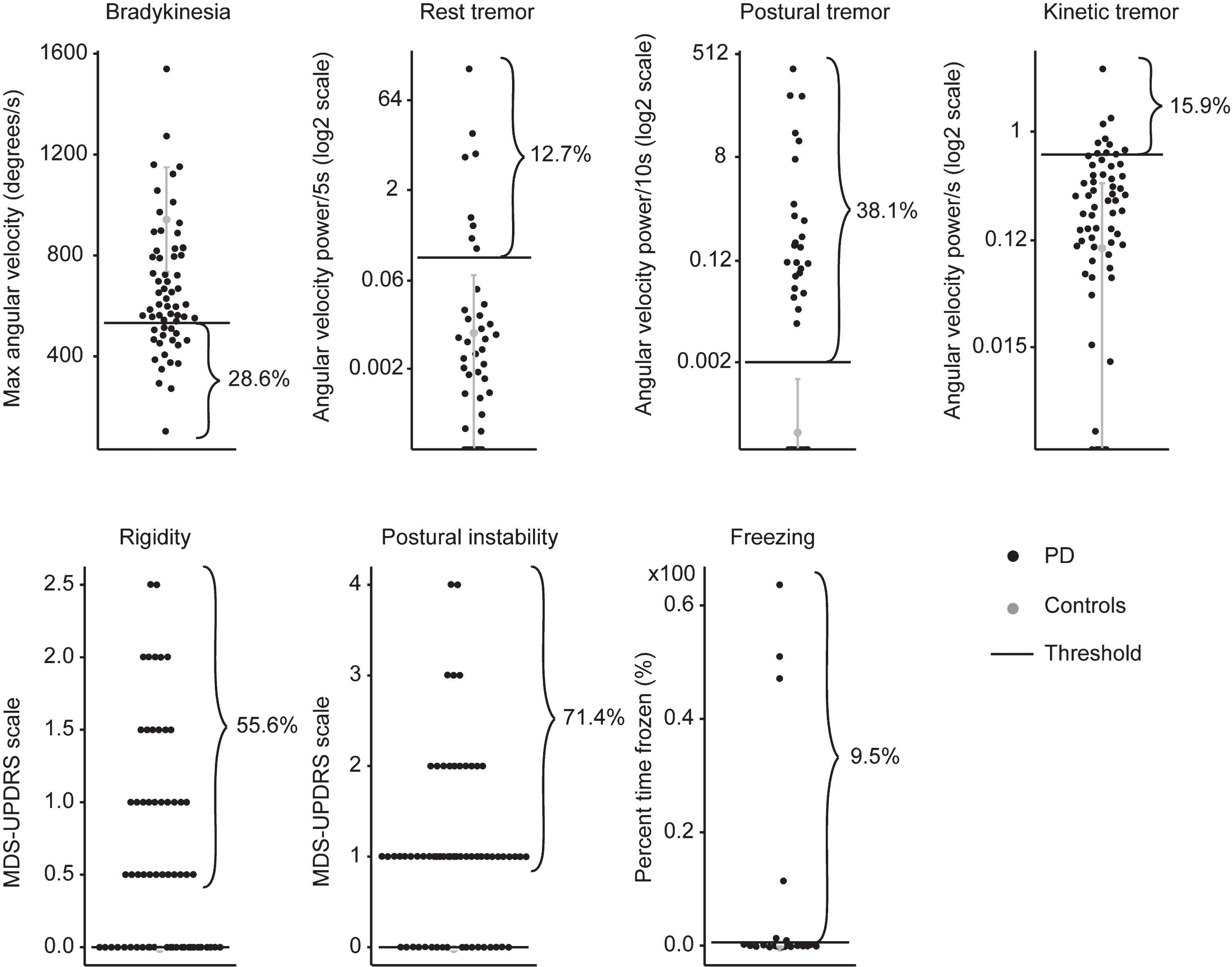 Level of cardinal motor symptoms in the 63 patients with PD who presented with DID (black), compared to normative values obtained from the control group (grey). Mean plus two standard deviations of data from controls are Illustrated in gray. Individual data points from patients are illustrated in black.