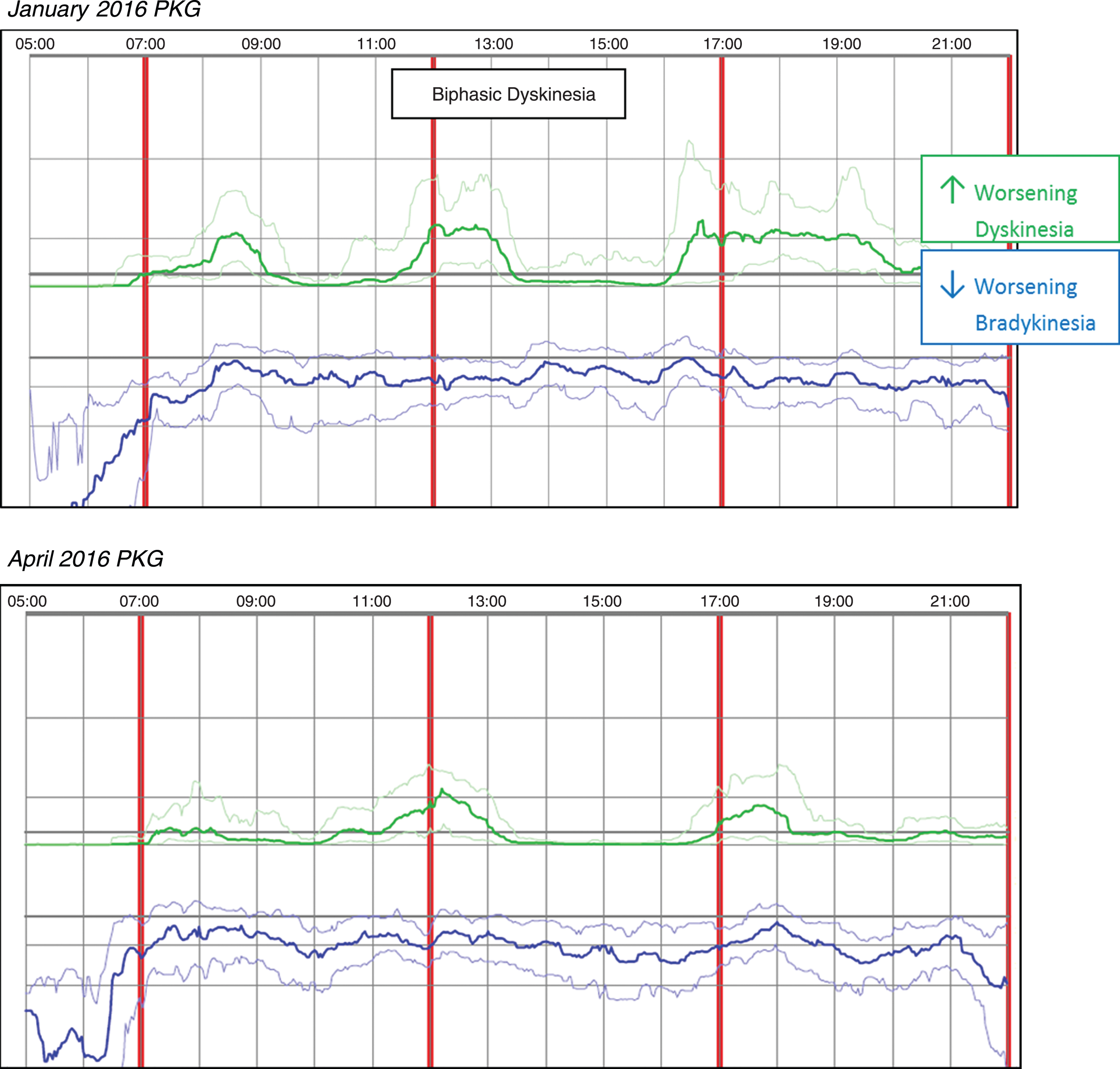 Patient No 18 January 2016 and April 2016 PKG. PKG Summary Plot depicts data from recording day aligned to the time of day. It shows when reminders were given (vertical red lines), the median DKS (heavy green line) and median BKS (heavy blue line) and their corresponding 25th and 75th percentiles plotted against time of day.