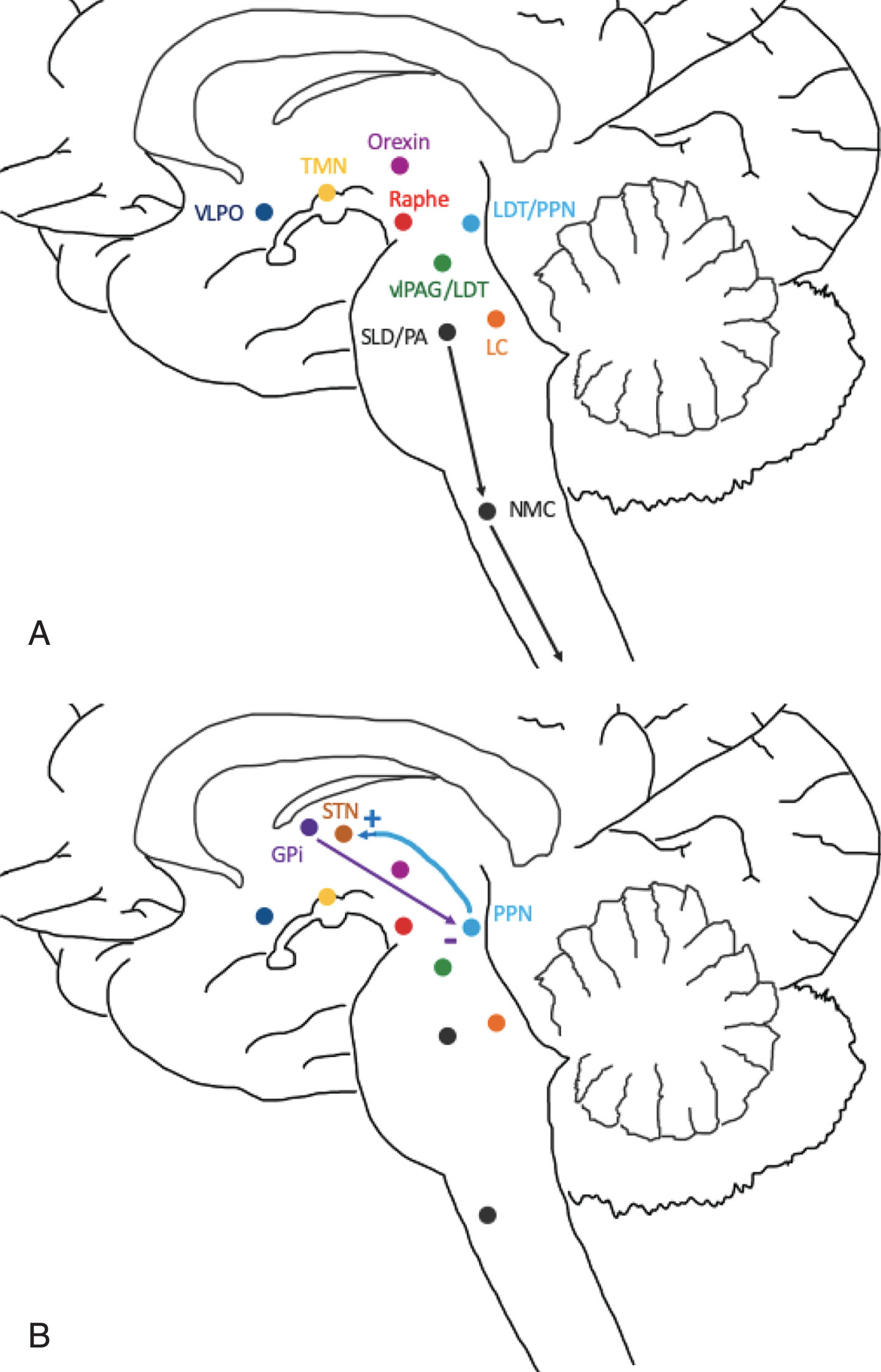 Areas of sleep-wake control and proposed connection to DBS targets: STN and GPi. A) Wakefulness is promoted by the excitatory interaction between orexin, locus coeruleus (LC), precoeruleus area (PA), raphe nucleus, ventral periaqueductal gray matter (vlPAG), tuberomammillary nucleus (TMN) and pedunculopontine tegmental nuclei (PPN). Sleep is induced by the ventrolateral preoptic area (VLPO) which inhibits the above nuclei. During REM, the sublateral dorsal nucleus (SLD), PA and PPN inhibit the lateral pontine tegmentum (LPT) and vlPAG. The SLD and PA also inhibit spinal cord motor neurons via the nucleus magnocellularis (NMC) to promote REM atonia. B) The STN receives excitatory cholinergic projections from the PPN and may act as a relay for information regarding wakefulness and REM sleep. The GPi sends inhibitory GABA projections to the PPN, likely reducing wakefulness and suppressing REM sleep.
