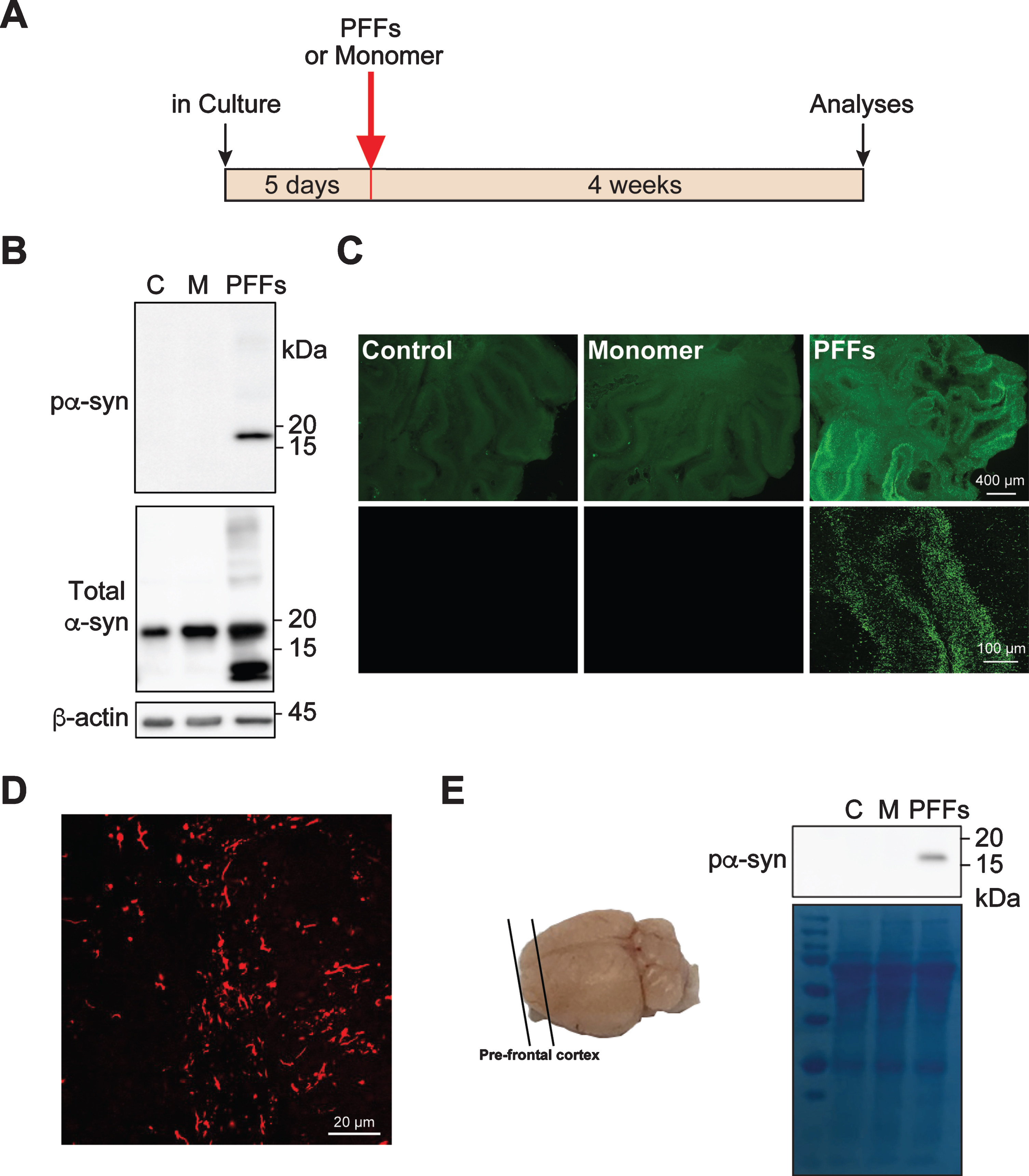 Exogenous PFFs induce pα-syn accumulation in cerebellar slice culture. A) Timeline for the experiment. B) Rat cerebellar slices were treated with PFFs, α-syn monomer (M) or untreated (C). Four weeks after the treatment, slices were lysed and the presence of pα-syn, total α-syn and β-actin were detected by immunoblot analyses. C) Representative epifluorescence (top panel) and confocal images (bottom panel) of pα-syn in slices that were untreated, α-syn monomer or PFF-treated for 4 weeks. Scale bars represent 400 μm (top panel) and 100 μm (bottom panel). D) A representative high magnification image of pα-syn in PFF-treated slice. Scale bar represents 20 μm. E) The schematic of brain slices prepared from pre-frontal cortex (PFC) is on the left. The mouse PFC slices were treated with PFFs, α-syn monomer (M) or no treatment (C) for 4 weeks and the accumulation of pα-syn was detected by immunoblot analysis. Equal loading was verified by Coomassie Blue stain of the blot.