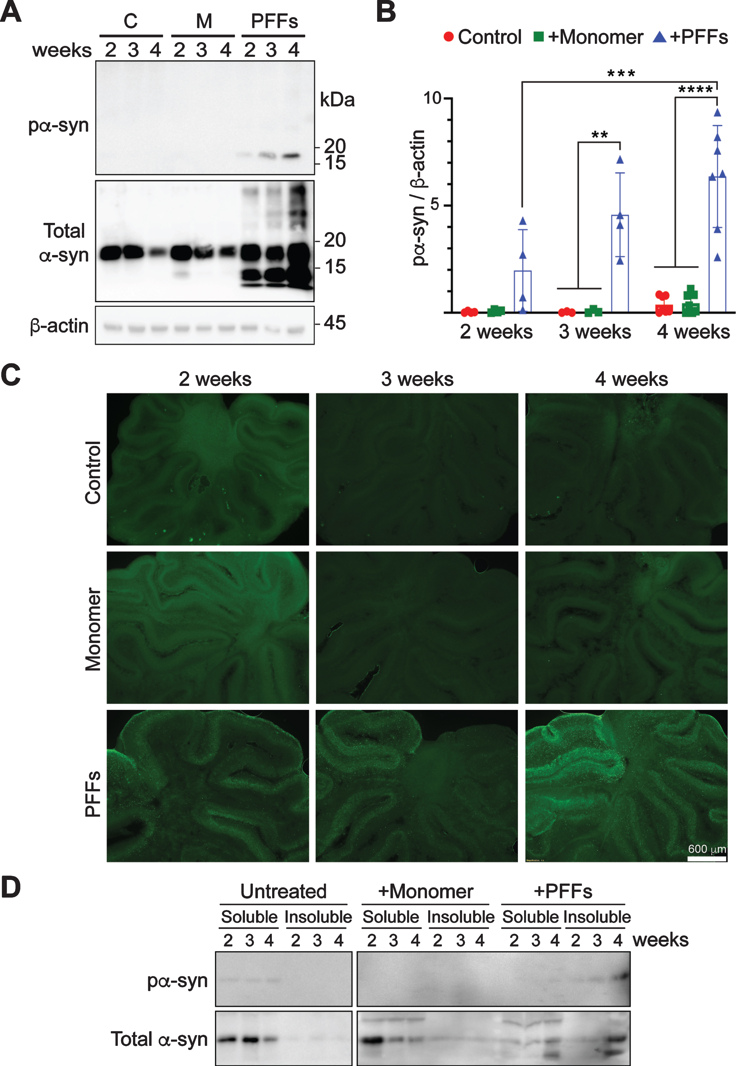 Time-dependent accumulation of pα-syn in PFF-treated cerebellar slices. A) Rat cerebellar slices were treated with PFFs, α-syn monomer (M) or untreated (C) for 2, 3, or 4 weeks as indicated. The presence of pα-syn, total α-syn and β-actin were detected by immunoblot analyses. B) Quantification of the results from immunoblot analyses. Error bar represents standard deviation. Statistical analysis was performed by two-way ANOVA with Tukey post hoc test (n = 4–7 independent cultures). ****p < 0.0001, ***p < 0.001, **p < 0.01. C) Immunofluorescence staining of pα-syn in slices treated with PFFs, α-syn monomer or untreated for 2, 3, or 4 weeks as indicated. Scale bar represents 600 μm. D) Cerebellar slices were untreated or treated with α-syn monomer or PFFs for 2, 3, and 4 weeks as indicated. Lysates were centrifuged at 110,000 g for 1 h at 4°C to separate soluble and insoluble fractions. Total α-syn and pα-syn were determined by immunoblot analyses.