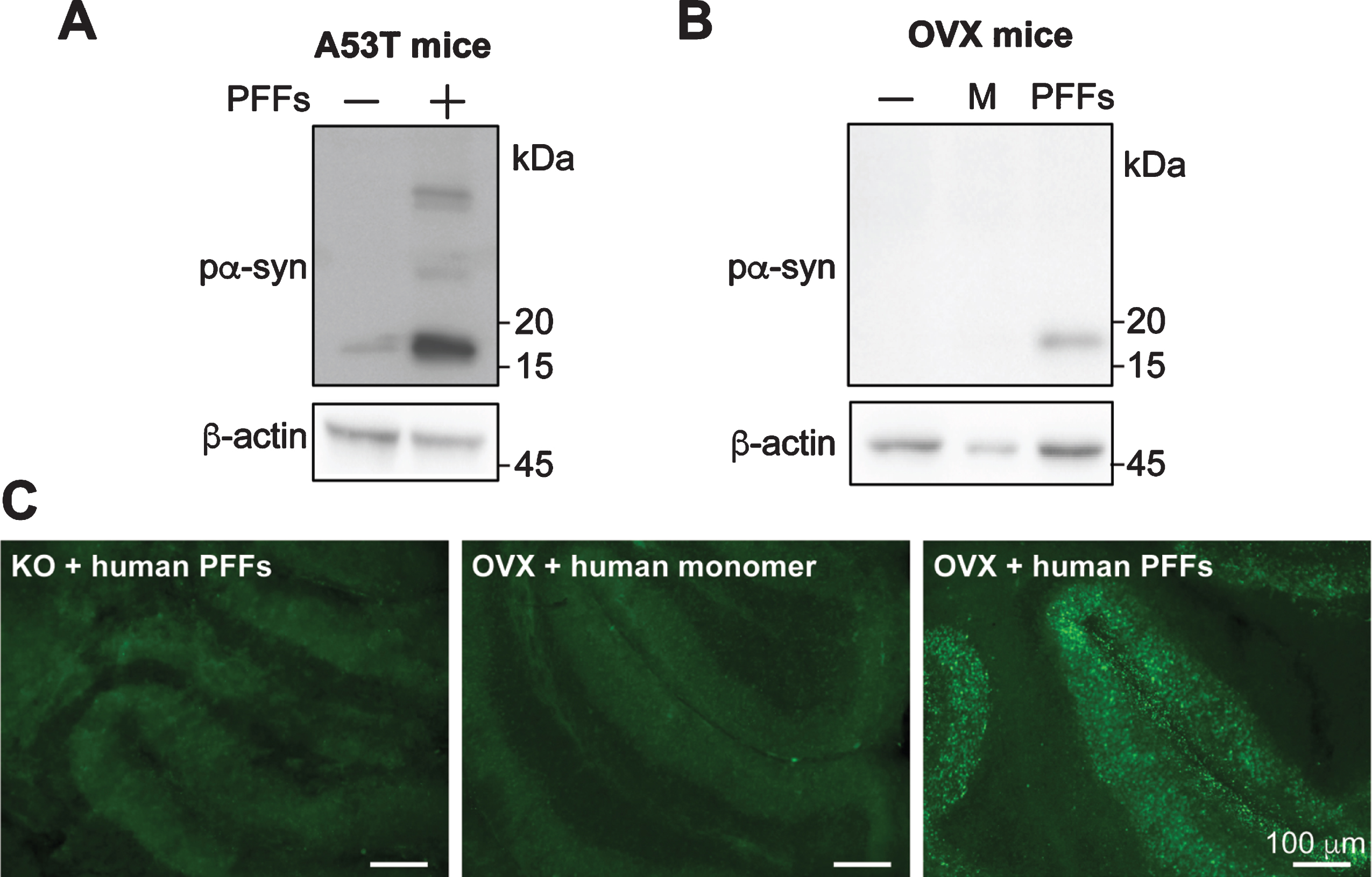 Human α-syn PFFs induce pα-syn accumulation in cerebellar slices prepared from transgenic mice expressing human α-syn transgene. Cerebellar slices were prepared from transgenic mice expressing human α-syn carrying A53T mutation (A) or wild-type α-syn (B). Slices were treated with human α-syn PFFs (PFFs), human α-syn monomer (M) or untreated (–). Four weeks after the treatment, the presence of pα-syn in these slices was determined by immunoblot analysis. C) Immunofluorescence staining of pα-syn in cerebellar slices prepared from transgenic mice overexpressing wild-type α-syn (OVX) or α-syn knock-out mice (KO) that received human α-syn PFFs or monomer treatment as indicated. Scale bar represents 100 μm.