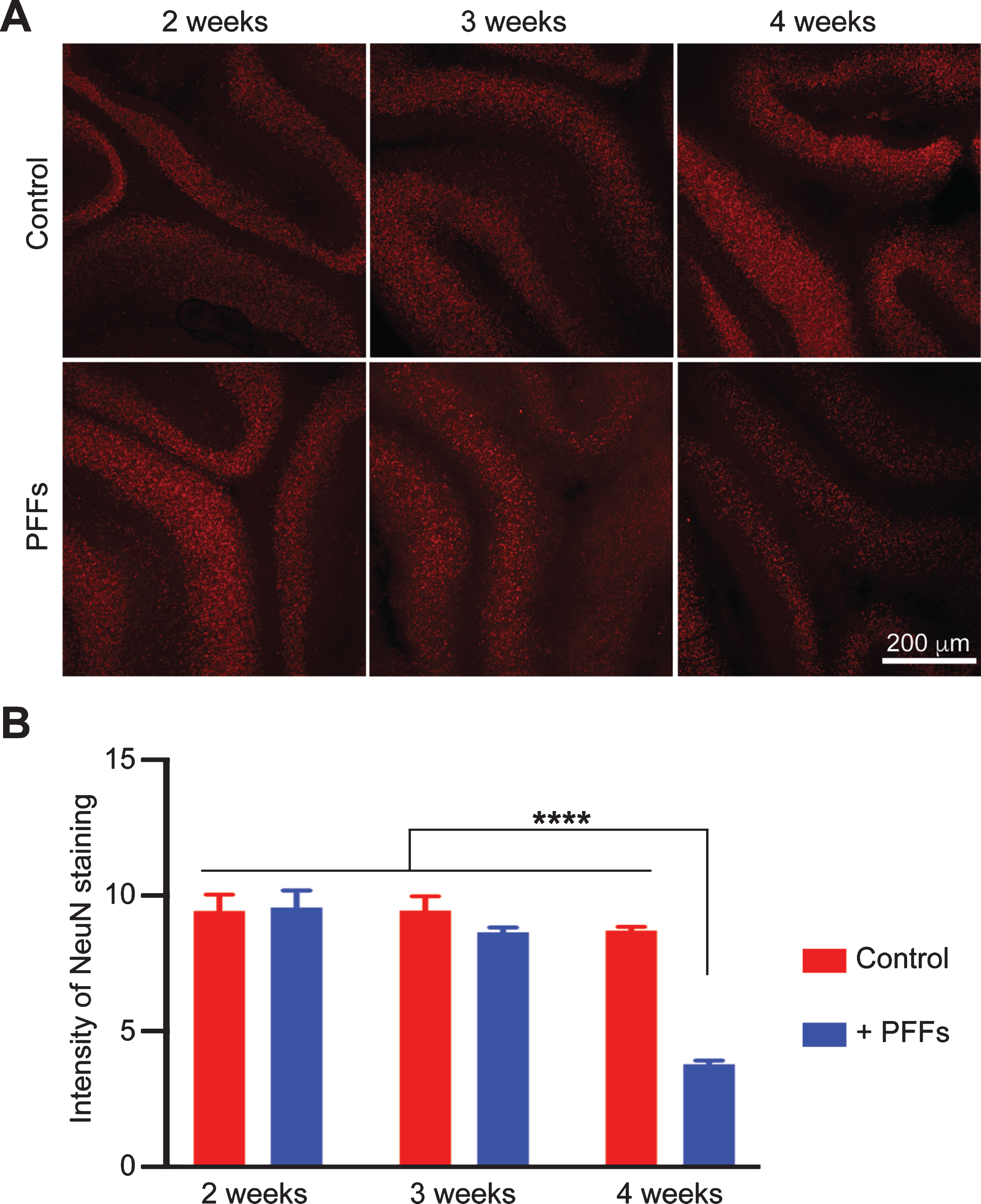 Time-dependent reduction in NeuN immunoreactivity in PFF-treated slices. A) Wild-type mouse cerebellar slices received no treatment (Control) or PFF-treatment for 2, 3 or 4 weeks as indicated. The immunofluorescence staining of NeuN was imaged by a Nikon A1plus-RSi scanning confocal microscope. B) Quantification of NeuN staining. Error bar represents standard deviation. Statistical analysis was performed by two-way ANOVA with Tukey post hoc test (n = 3 independent cultures). ****p < 0.0001. Scale bar represents 200 μm.