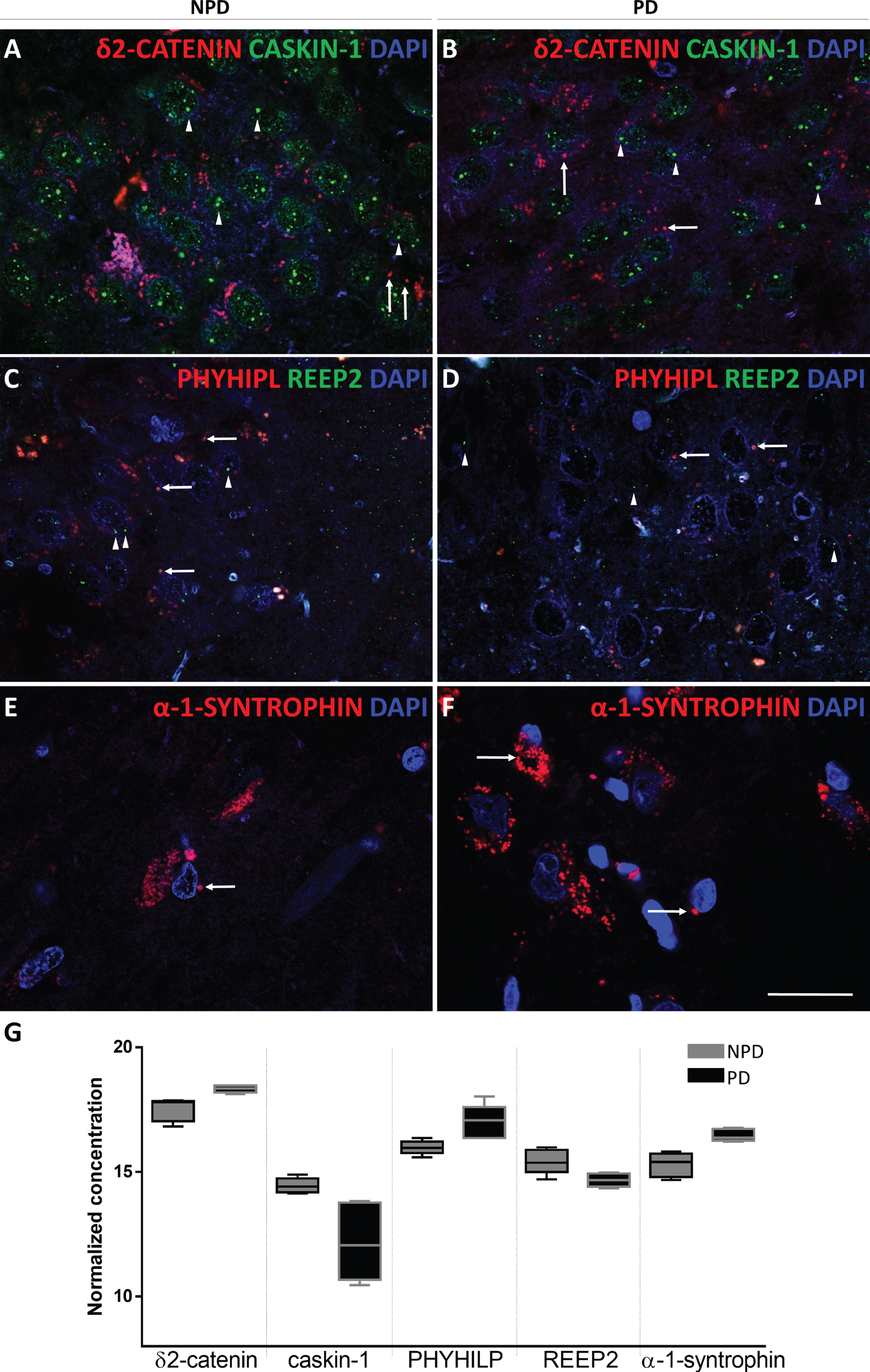 Coronal sections of the human hippocampus immunofluorescently stained for δ2-catenin (RED) and caskin-1 (GREEN) in NPD (A) and PD (B), REEP2 (GREEN) and PHYHIPL (RED) in NPD (C) and PD (D) and α-syntrophin (RED) in NPD (E) and NPD (F). Arrow heads and arrows point green and red markers, respectively. Scale bar 20μm (A-F). The mean±SD of selected proteins comparing NPD and PD (G).