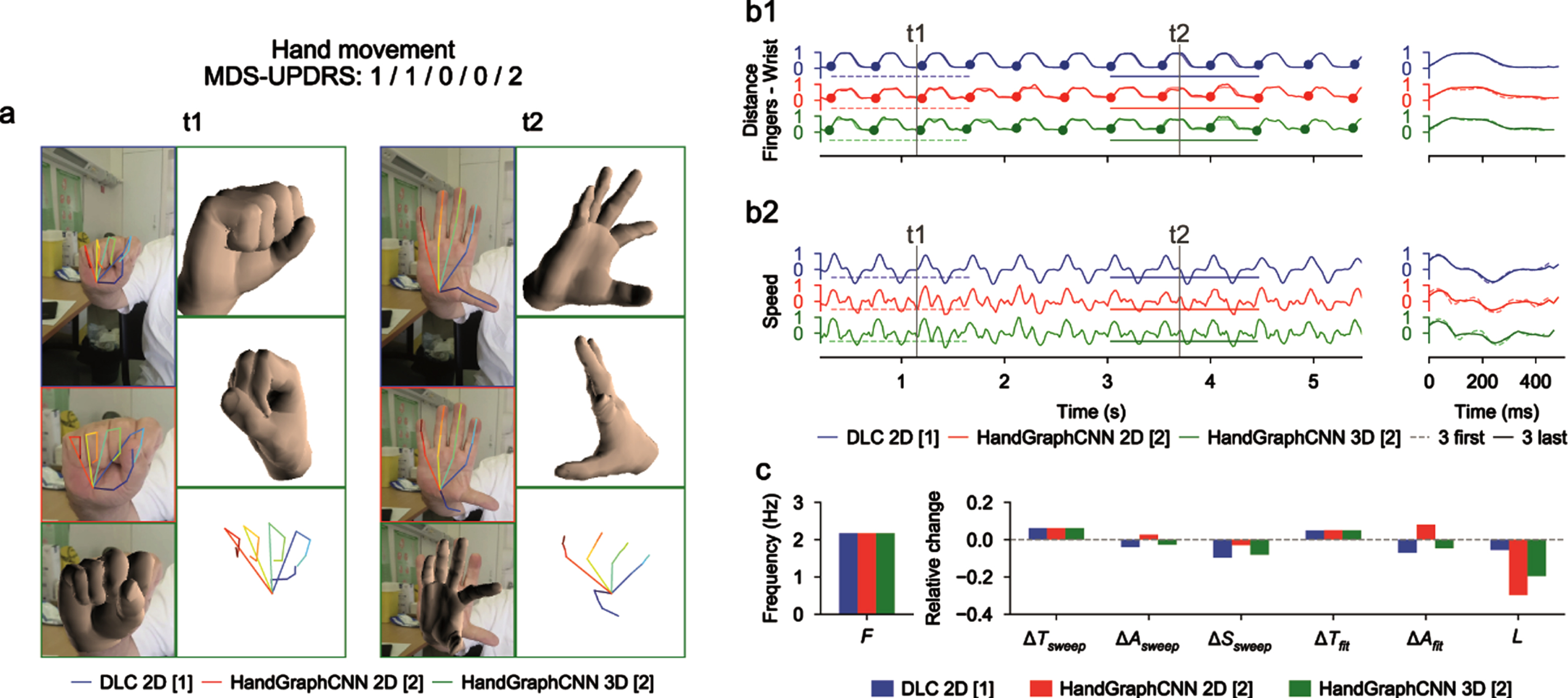 Video analysis using deep learning algorithms for hand movements protocol (associated Supplementary Movie 2). a) Snapshots from the initial videos, with the different skeletons extracted using the two deep learning algorithms (blue DeepLabCut 2D, red HandGraphCNN 2D, green HandGraphCNN 3D). b1, left) Evolution of the averaged distance between each finger tip and the wrist point with 9 sweeps (delimited by the 10 plain circles on each trajectory). b1, right) First three sweeps (dotted lines) compared to the last three ones (plain lines). b2) same as (b1) for the speed. c) Frequency F, fatigue L, relative variation of the period ΔTsweep, amplitude ΔAsweep, speed ΔSsweep accross the protocol, more complex variation coefficients, ΔTfit and ΔAfit based on the fit of a periodic function.