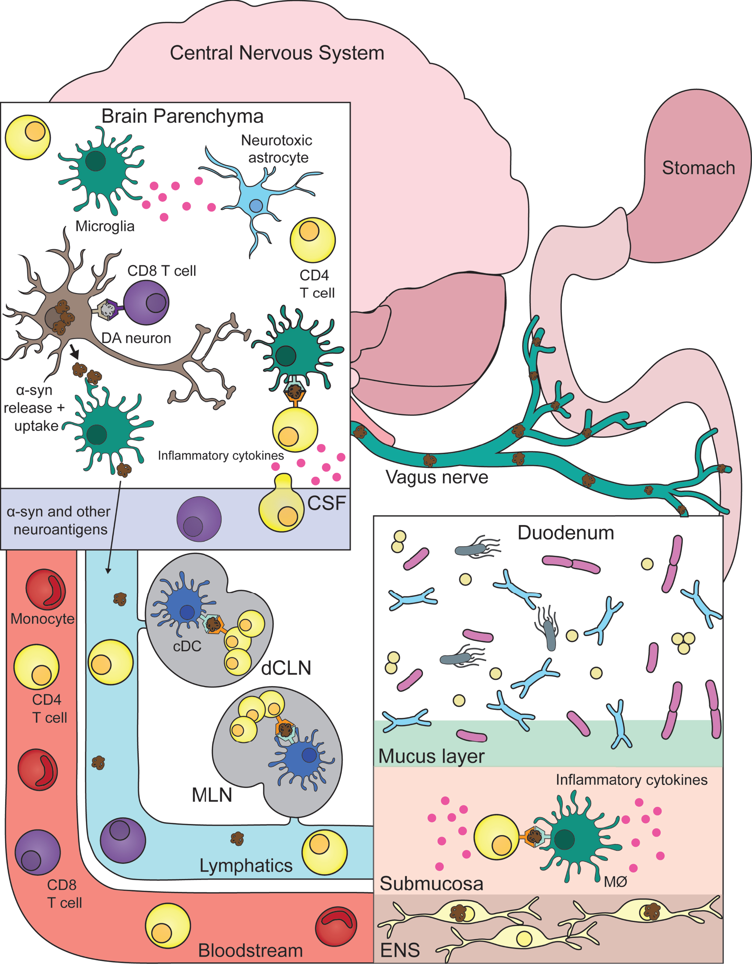 Connecting central and peripheral immune responses in Parkinson’s disease. Inflammatory and damaging events in the gastrointestinal tract (duodenum) caused by a combination of environmental, genetic, microbial, and immune factors leads to α-synuclein (α-syn) pathology in the innervating enteric nervous system (ENS). Misfolded α-syn species within the ENS may become targets for resident macrophages (MØ) with subsequent antigen presentation to T cells that misrecognize self-peptide and possibly expand in the gut-draining mesenteric lymph nodes (MLN). This α-syn provoked inflammatory response promotes further α-syn pathology and eventual propagation to the central nervous system via the vagus nerve. Now α-syn pathology with neurons leads to similar inflammation as described in the gut. With microglia taking up pathogenic α-syn—leading to their activation (and subsequent activation of neurotoxic astrocytes) and presentation of α-syn antigen to cerebrospinal fluid (CSF) patrolling T cells. Another link between the two distant systems is also the bloodstream that connects them. T cells and other immune cells may be able to extravagate through the blood-brain barrier in response to heightened inflammation coming from the brain parenchyma/CSF. Lastly, similar to the MLN, T cells may be encountering and expanding to α-syn and other autoinflammatory neuroantigens within the central nervous system draining deep cervical lymph node (dCLN). DA, dopamine; cDC, classical dendritic cell.