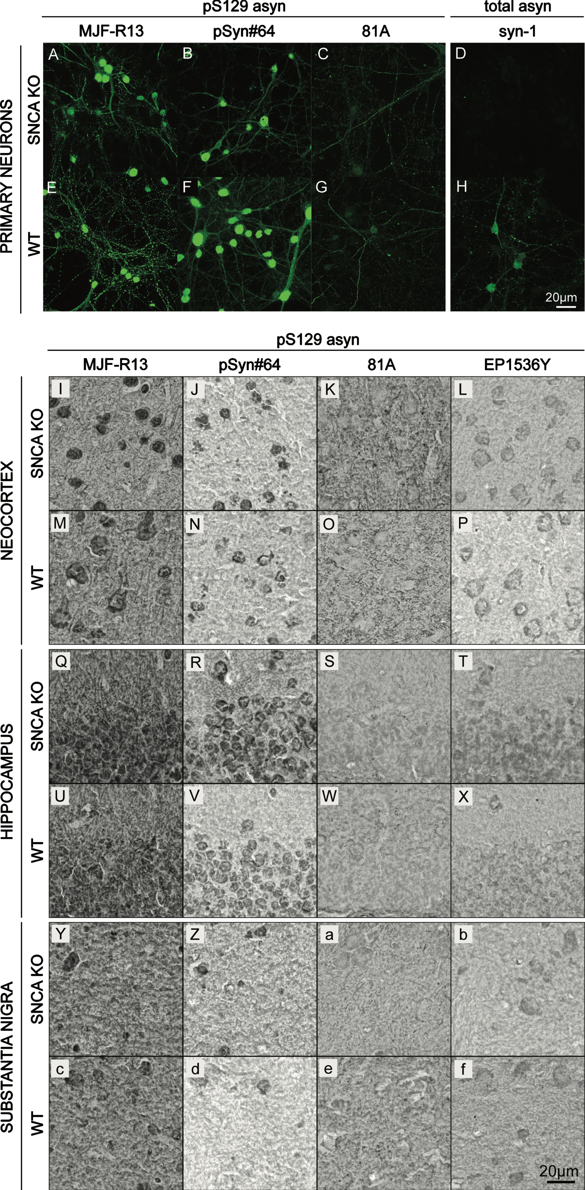 Cross-reactivity of pS129 α-synuclein monoclonal antibodies in cell culture and mouse brain sections. A–H) Immunocytochemistry staining (ICC) of SNCA KO (A–D) and WT (E–H) mouse primary cortical neurons using rabbit MJF-R13 (A,E), mouse pSyn#64 (B,F), and mouse 81A (C,G). Total-asyn antibody, mouse syn-1 (D,H), was used for reference. Alexa-488 stained images were taken at 63x. I-f) Immunohistochemistry staining (IHC) of SNCA KO (I-L,Q-T,Y-b) and WT (M-P,U-X,c-f) 30μm thick coronal mouse brain sections with rabbit MJF-R13 (I,M,Q,U,Y,c), mouse pSyn#64 (J,N,R,V,Z,d), mouse 81A (K,O,S,W,a,e), and rabbit EP1635Y (L,P,T,X,b,f). DAB-stained images were taken at 63x.