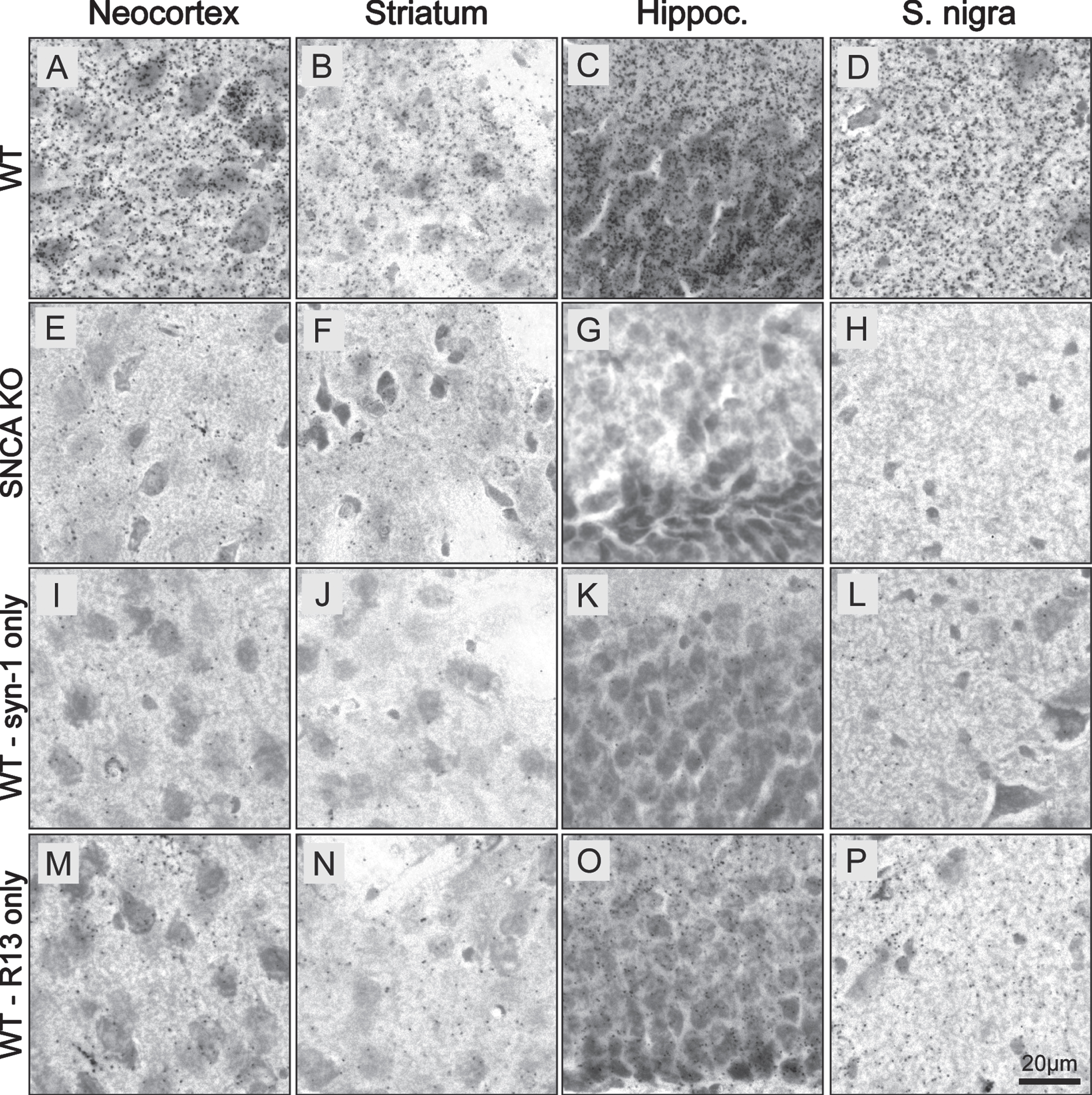 BF-PLA specifically detects pS129 α-synuclein in mouse brain sections. A-P) BF-PLA staining of pS129 asyn was performed on coronal mouse brain sections (30μm). R13 (1:1,000) and syn-1 (1:2,000) monoclonal antibodies were used together (A–H). The BF-PLA was also performed using either syn-1 (I–L) or R13 (M–P) alone as controls. WT (A-D,I-P) or SNCA KO sections (E–H) containing neocortex (A,E,I,M), striatum (B,F,J,N), hippocampus (C,G,K,O), and substantia nigra (D,H,L,P) were used.