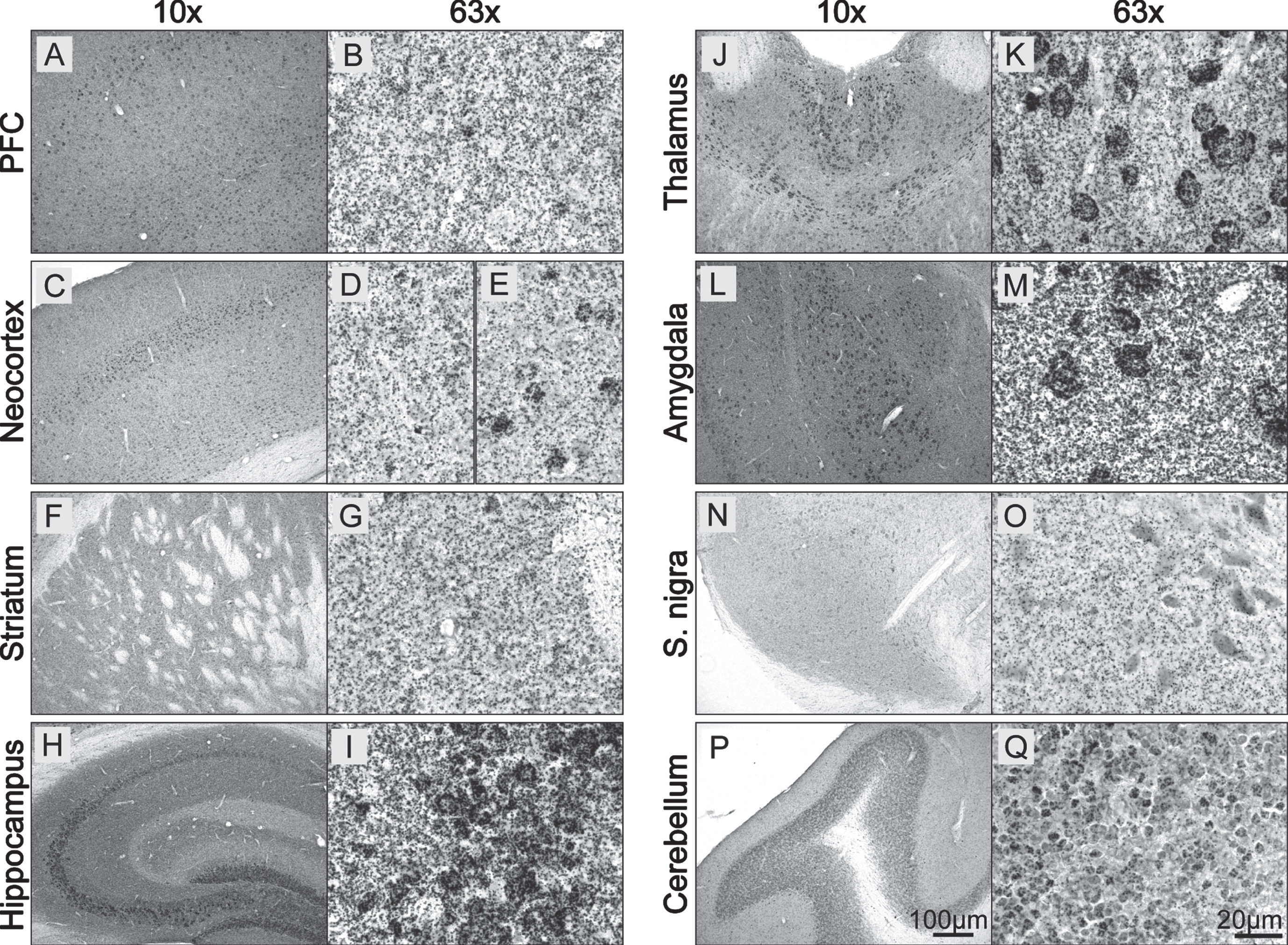 Physiological pS129 α-synuclein staining in the mouse brain. A–Q) WT coronal mouse brain sections (30μm) were stained using the BF-PLA technique. Examples of prefrontal cortex (PFC; A,B), neocortext (C–E), striatum (F,G), hippocampus (H,I), thalamus (J,K), amygdala (L,M), substantia nigra (S. nigra; N,O) and cerebellum (P,Q) are shown in 10x (A,C,F,H,J,L,N,P) and 63x (B,D-E,G,I,K,M,O,Q) magnification.