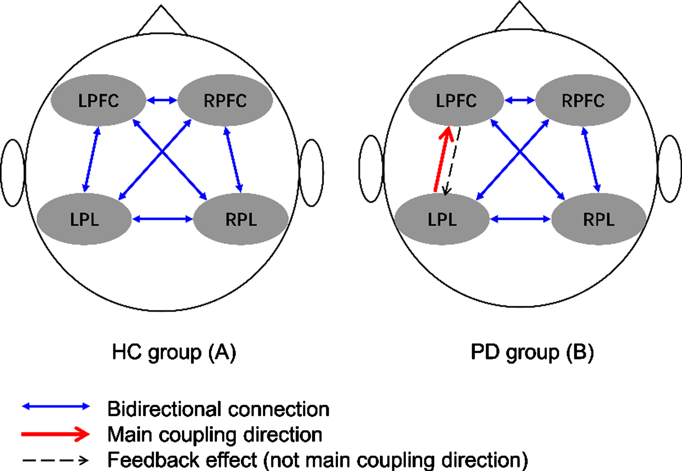 Main coupling directions (mCDs) among brain regions in healthy controls (A) and individuals with Parkinson’s disease (B). LPFC, left prefrontal cortex; LPL, left parietal lobe; RFFC, right prefrontal cortex; RPL, right parietal lobe.