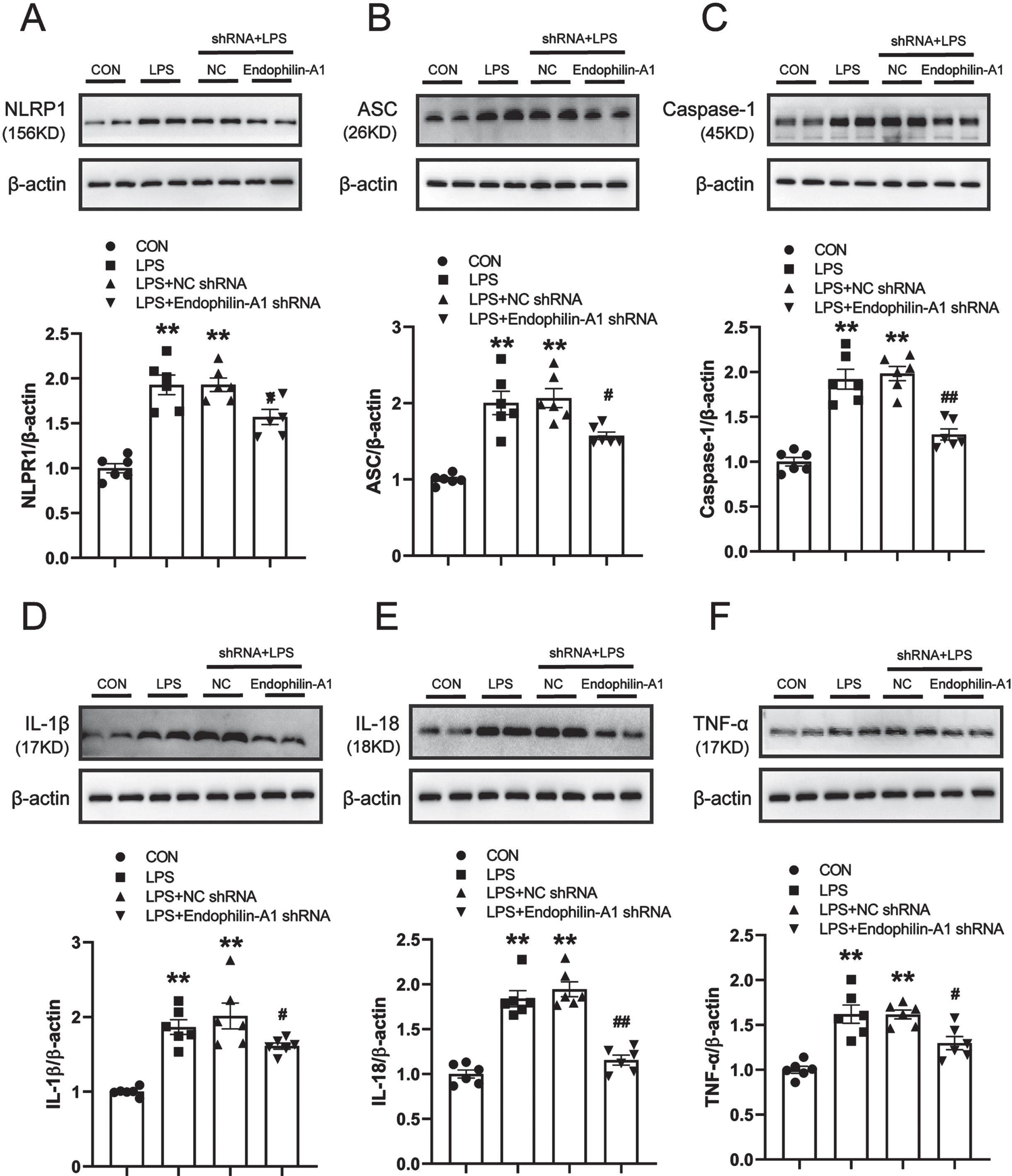 EPA1 knockdown alleviates NLRP1 inflammasome activation and related inflammatory responses in the SN of LPS-induced PD model mice. A–F) Western blot for NLRP1, Caspase-1, ASC, IL-1β, IL-18, and TNF-α protein level. Data are expressed as mean±SEM (n = 6). **p < 0.01 vs. the control group, #p < 0.05, # #p < 0.01 vs. the LPS+NC shRNA group.