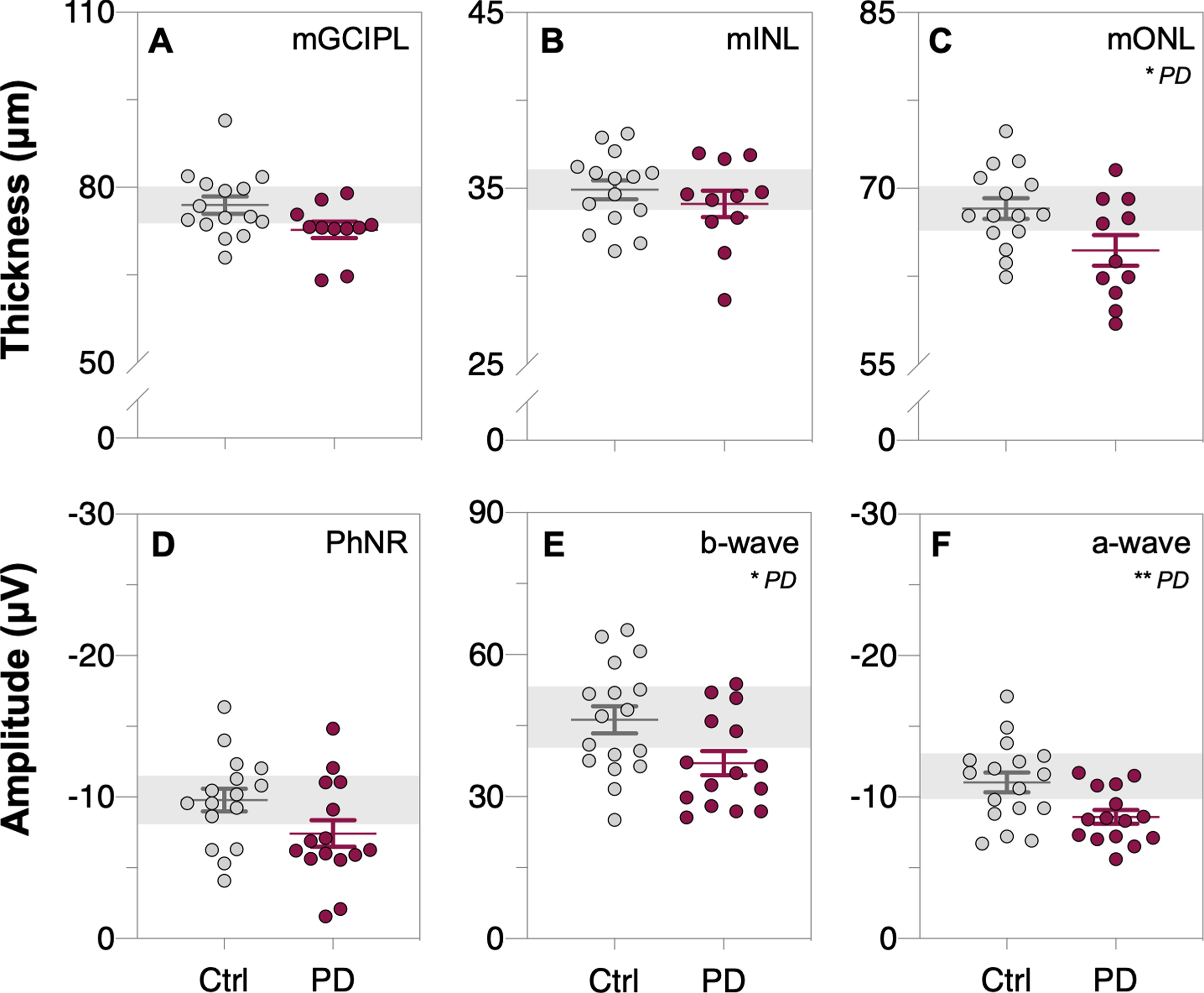 Comparison of inner and outer retinal layer thicknesses and function between control and Parkinson’s disease participants before L-DOPA treatment (i.e., first OCT/ERG measurement of both groups). Raw macular thickness values of the: ganglion cell inner plexiform layer, mGCIPL (A); inner nuclear layer, mINL (B) and outer nuclear layer, mONL (C) as measured by optical coherence tomography (OCT). Light-adapted electroretinogram (ERG) photopic negative response (PhNR, D), b-wave (E) and a-wave (F) amplitudes, respectively. Thinning in the mONL and smaller a-wave and b-wave amplitudes were observed in Parkinson’s disease (PD) participants compared to control participants. Grey data dots denote control group data and purple data dots denote Parkinson’s disease group data. All data shown, mean±SEM; *p < 0.05 and/or **p < 0.01 for PD effect on unpaired Student’s t-test analyses; grey shaded area, 95% CI of control group mean.