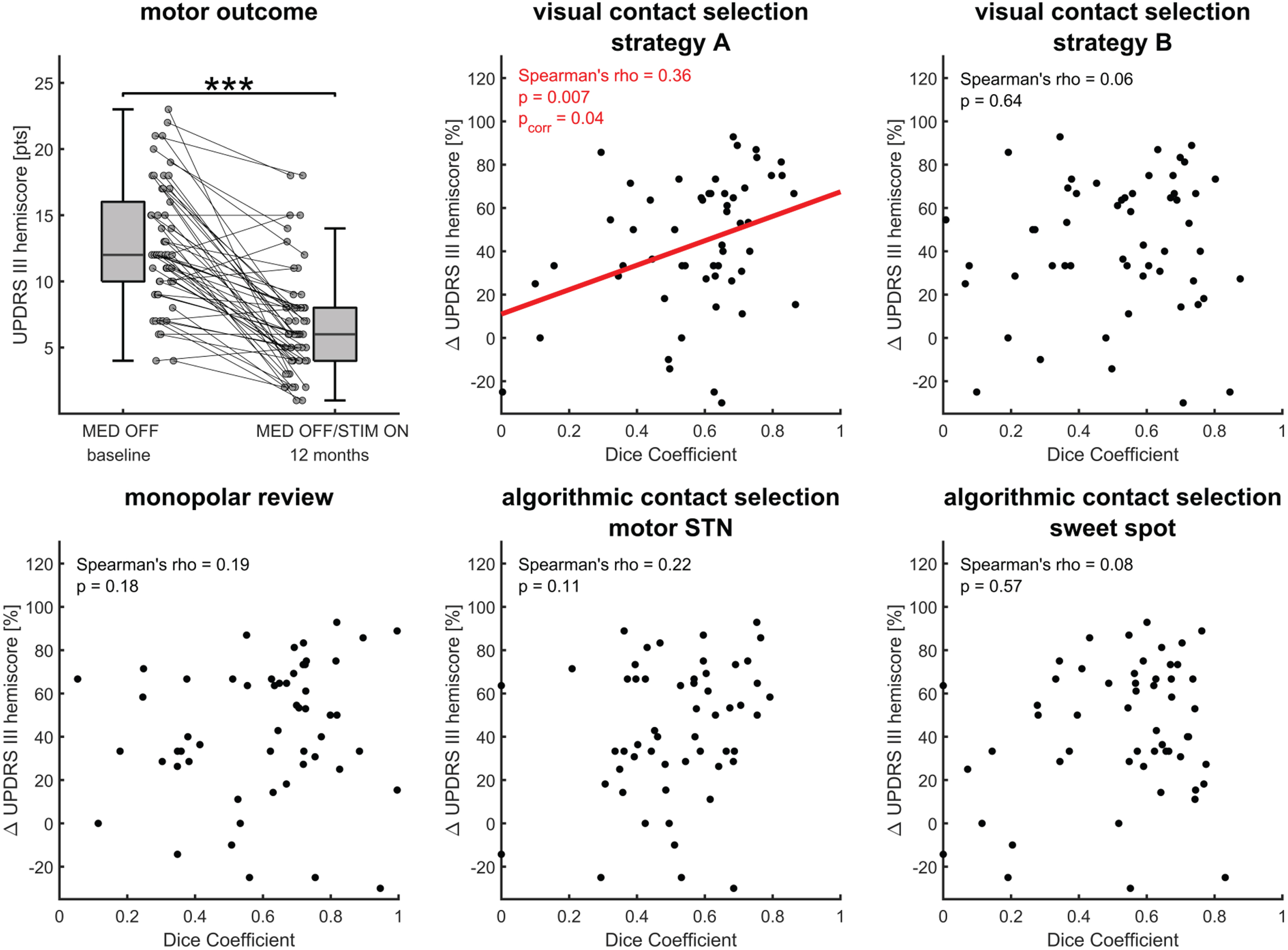 Lateralized motor outcomes in correlation to contact selection strategies. A) Compared to preoperative baseline (MED OFF), UPDRS III hemiscore significantly improved in MED OFF/STIM ON 12 months after surgery. ***p< 0.001 (paired t-test). B-F) Lateralized motor outcomes were significantly correlated to the dice coefficients (DC) between chronic stimulation and visual contact selection focussed on the dorsal motor STN (VISUAL-A). DCs of the contact selection based on the monopolar review (MPR), an alternative visual contact selection strategy involving the dorsal adjacent white matter (VISUAL-B), algorithmically optimized coverage of the motor STN (ALGO-mSTN), or the sweet spot (ALGO-sweetspot) were not correlated to changes in UPDRS III hemiscore [15]. In the case of statistical significance, a least-squares regression line (red) was added as a visual reference.