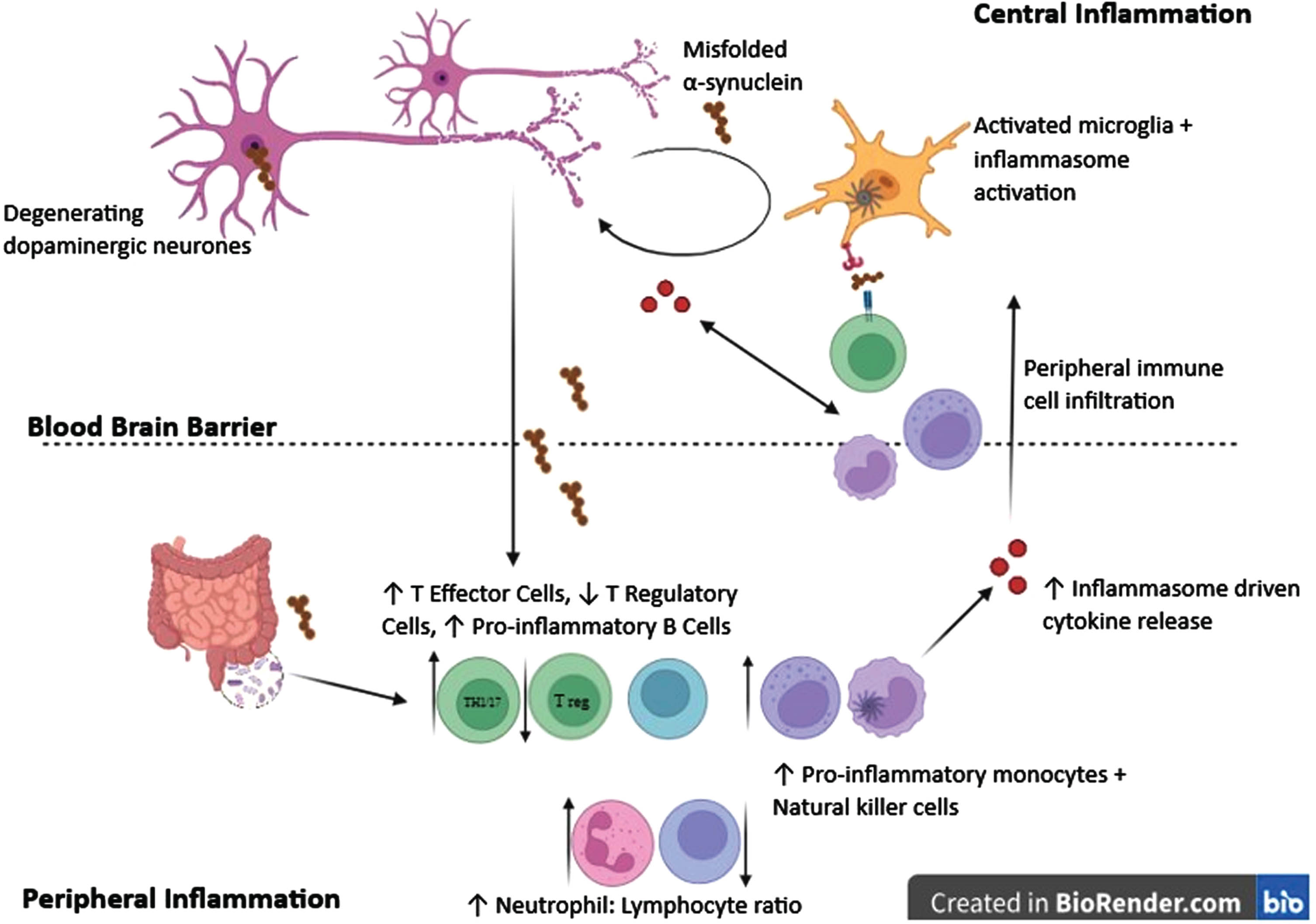 Overview of the immune system and inflammation in Parkinson’s disease (PD). Immune changes and inflammation occur both within the brain and periphery in PD. Activated microglia are found throughout the brain with evidence of NLRP3 inflammasome activation. This leads to the release of inflammatory cytokines which have a toxic effect on neurons, and release of chemokines which recruit peripheral immune cells to the central nervous system. Peripherally there is evidence of both innate and adaptive immune cell dysfunction with an increase in the neutrophil to lymphocyte ratio in the blood, and a shift towards a more inflammatory phenotype of T and B lymphocytes as well as natural killer cells and monocytes. NLRP3 inflammasome activation occurs within peripheral innate immune cells as well as centrally, and proinflammatory cytokines in peripheral blood are increased. Misfolded alpha synuclein may act as a driver of innate immune activation both peripherally and centrally, and trigger a specific adaptive immune response.