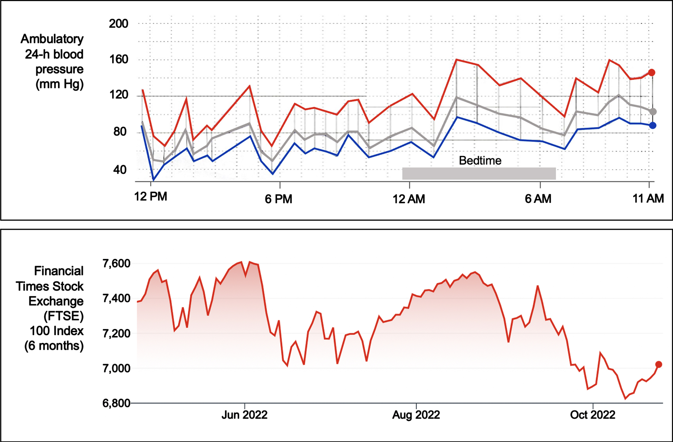 Blood pressure variability and stock market volatility. The upper panel shows an ambulatory 24-hour blood pressure (BP) monitor recording of a patient with Parkinson’s disease with neurogenic orthostatic hypotension and supine hypertension. The monitor takes a BP measurement every 30 minutes during the daytime and every 60 minutes during nighttime. The red line denotes systolic BP, the blue line diastolic BP, and the grey line mean BP. The tracing depicts high BP variability with low (as low as 65/32 mmHg at around 6 PM) and high blood pressure readings (as high as 160/100 mmHg at around 2 AM, during bedtime). Note that for several hours during bedtime (i.e., supine position), multiple BP readings were in the hypertensive range. The lower panel shows a 6-month tracing (May-October 2022) of the London Financial Times Stock Exchange (FTSE) 100 Index, depicting high variability.