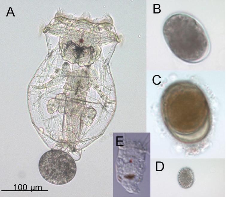 Adults and eggs of the rotifer Brachionus manjavacas. (A) Female B. manjavacas carrying one egg. Females have apical cilia for swimming and feeding, a red eyespot used for sensing light; and digestive, reproductive, muscle, and nervous systems visible through a transparent body wall. (B) Amictic egg, produced asexually via mitosis, which will hatch into an asexual female. (C) Dormant resting egg, the product of sexual reproduction. (D) Small egg that will hatch into a male; (E) Male, with cilia for swimming and red eyespot, but no mouth or gut. Males are one-third the size of females and are haploid.
