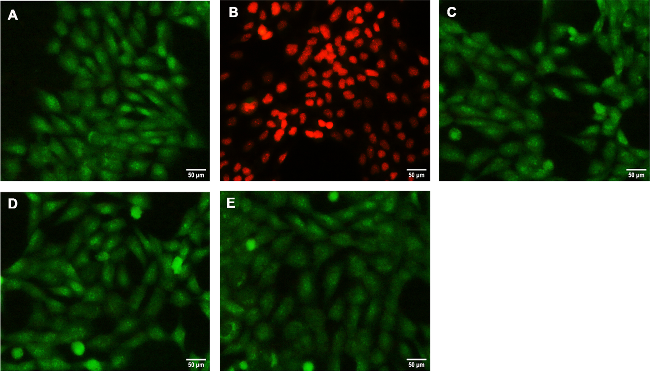 Fluorescent microscopic examination of inhibition of apoptosis by HS (A) Control (B) Glutamate (5 mM) (C) HS-5 + glutamate (D) HS-10 + glutamate (E) HS-10. Green staining indicates live cells and orange red staining denotes apoptotic cells.