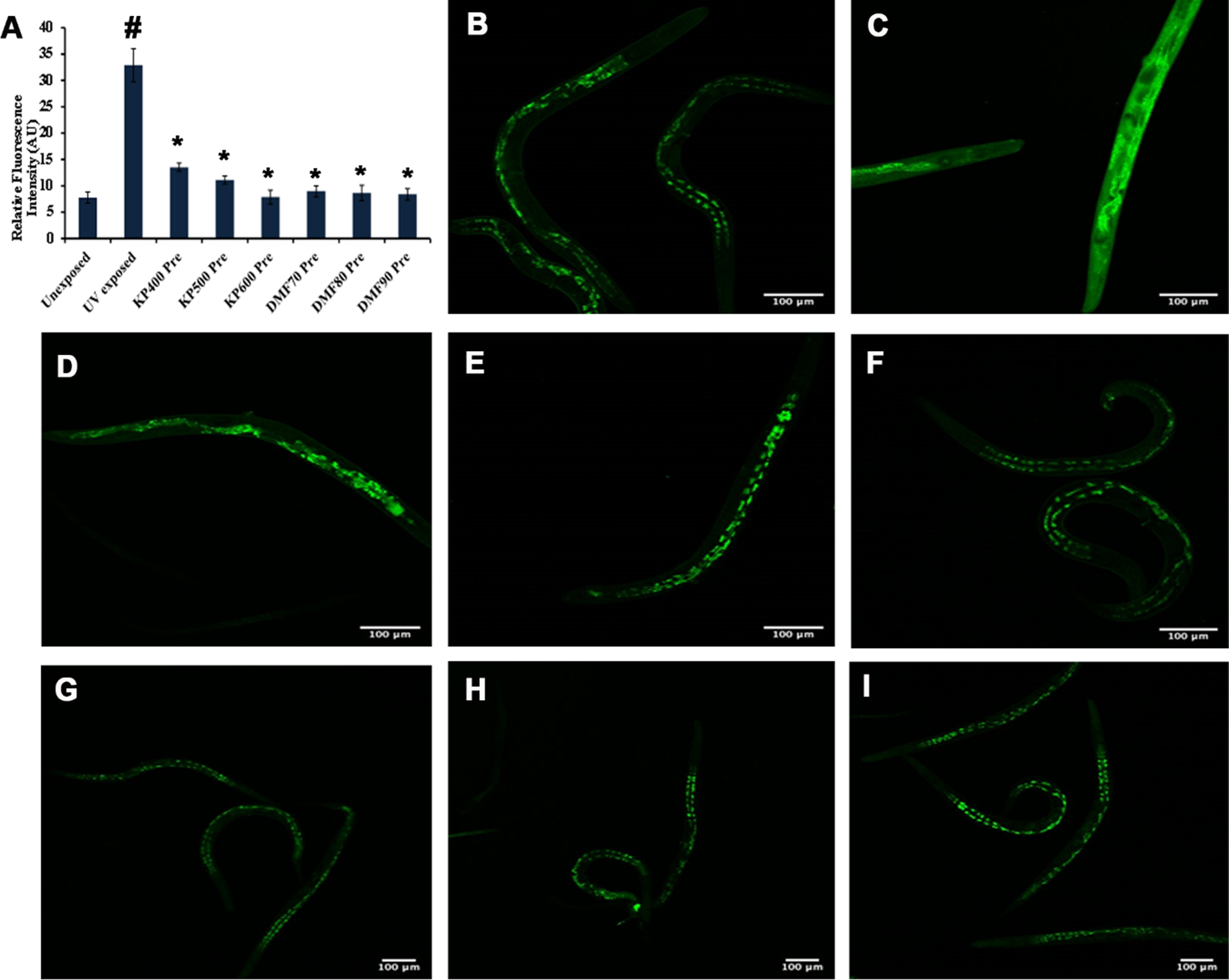 KP and DMF could reduce ROS formation (A) Quantification of ROS fluorescence intensity in N2 worms pre-treated with KP (400 –600μg/ml) and DMF (70 –90μM) (n = 10; significance at p <  0.05 # Control vs UV-A treated; *UV-A treated vs UV-A + KP/DMF treated Representative image of worm showing the level of ROS (B) Un-exposed control (C) UV-A exposed (D –F) KP (400 –600μg/ml) pre-treatment + UV-A exposure (G –I) DMF (70 –90μM) pre-treatment + UV-A exposure.