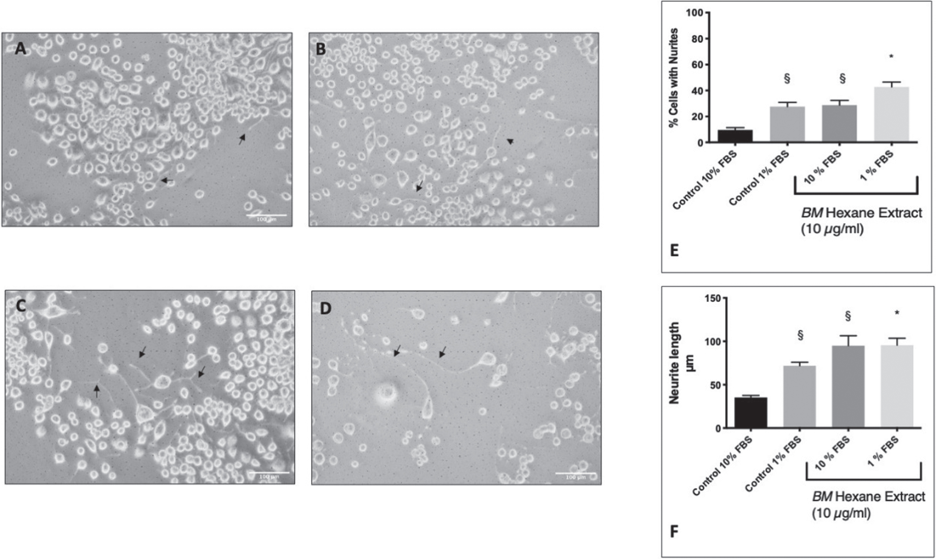 The effect of BM on serum starvation induction of neurite outgrowth in Neuro2A cells. Black arrows indicate examples of neurites. A Control Neuro2A cells in DMEM 10% FBS. B Control Neuro2A cells in DMEM 1% FBS. C BM (10 μg/ml) treated Neuro2A cells in DMEM 10% FBS. D BM (10 μg/ml) treated Neuro2A cells in DMEM 1% FBS. E The percentage of cells showing neurite growth. §Statistical significance compared to control 10% (ANOVA followed by Tukey’s post hoc test) p = 0.018 (control 1% FBS) p = 0.013 (10% FBS+BM 10 μg/ml). * Statistical significance compared to control 1% FBS (ANOVA followed by Tukey’s post hoc test) p = 0.04. F Neurite length. §Statistical significance compared to control 10% (ANOVA followed by Tukey’s post hoc post hoc test) p = 0.0267 (control 1% FBS) p = 0.0007 (10% FBS+BM 10 μg/ml). * Statistical significance (ANOVA followed by Tukey’s post hoc multiple comparison test) compared to control 1% FBS p = 0.047.