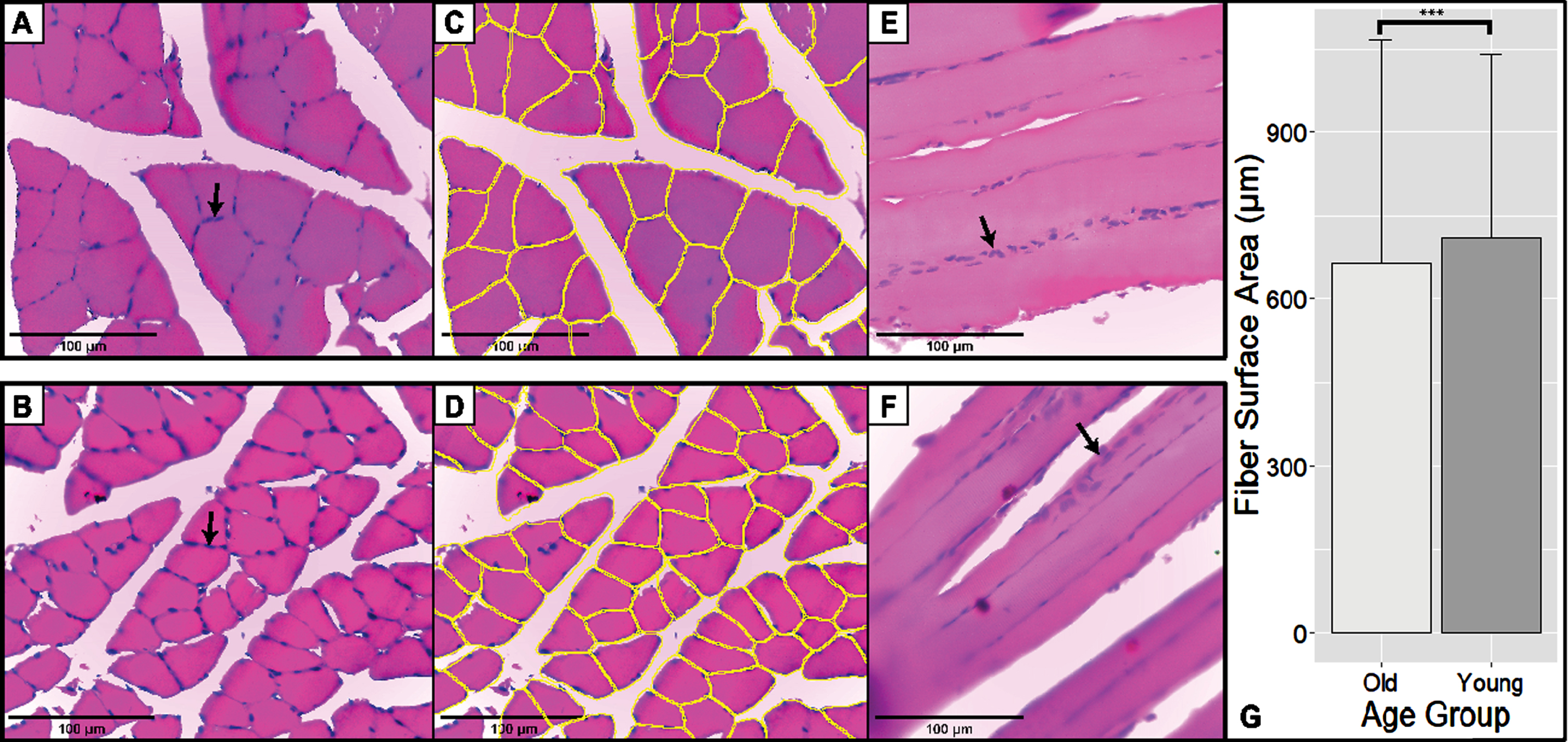 H&E Staining of Skeletal Muscle in Transverse and Longitudinal Section. Scale bar: 100μm. Black arrows showed the peripheral nucleus of skeletal muscle cells. (A-B) Representative pictures of transverse old rats (above) and young rats (below). These sections are typical H&E-stained sections. (C-D) Fiber segmentation is done on sections A and B using the Cellpose Algorithm. Yellow outlines correspond to the individual muscle fibers recognized by the algorithm. (E-F) Representative pictures and longitudinal sections of old rats (above) and young rats (below). (G) Fiber surface area of old and young rats. Old rats have a smaller soleus fiber surface area compared to younger controls (p < 0.001; 42.83μm2 (22.35μm2–63.14μm2)).