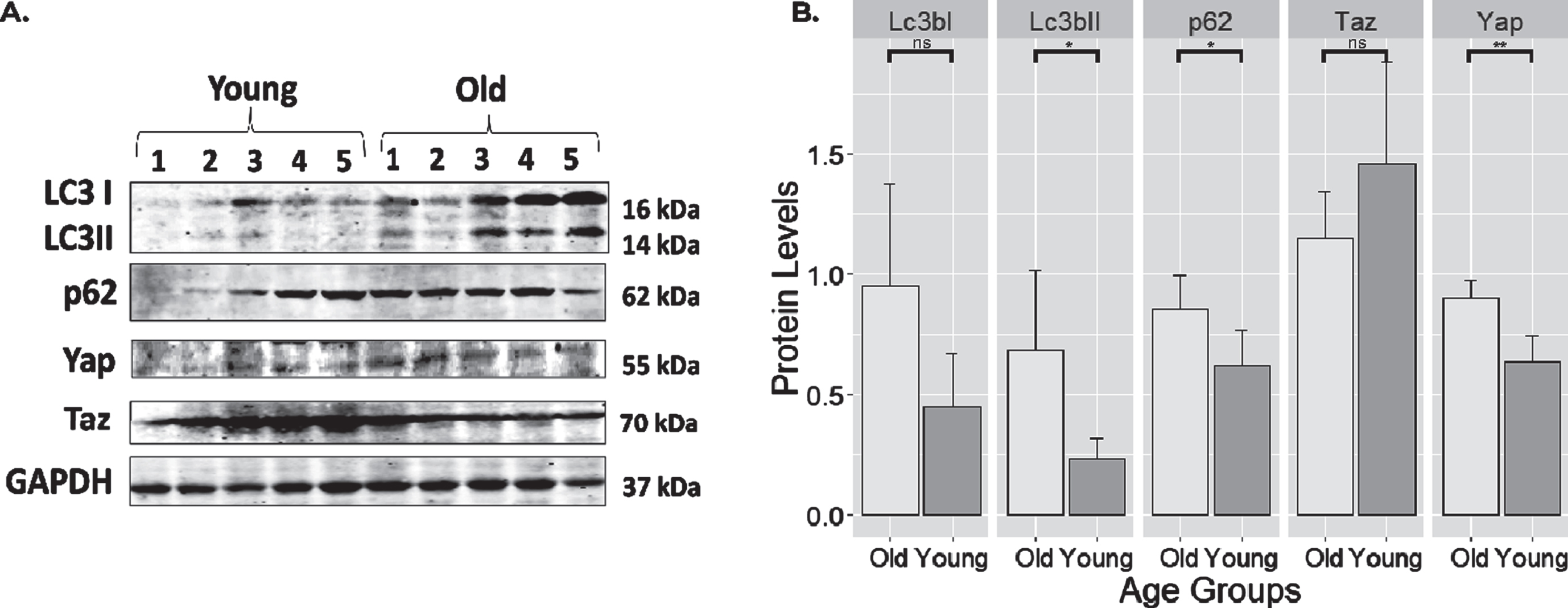 Expression of select proteins from old and young rat skeletal muscle. (A) Full blot of Lc3, p62, Yap, Taz, and Gapdh. (B) protein expression levels normalized to Gapdh. Notice that autophagy markers such as Lc3bII (p < 0.05; 0.45 (0.046–0.857)) and p62 (p < 0.05; 0.233 (0.022–0.445)) markers were highly expressed in old muscle. Yap also has a higher expression (p < 0.01; 0.267(0.129–0.405)) in old rats compared to younger controls. The levels of Lc3bI and Taz were unchanged. **: highly significant differences with the level of p < 0.01. *: significant difference compared at the level of p < 0.05. ns: no significant differences with the level of p > 0.05. Error bars: standard deviation.