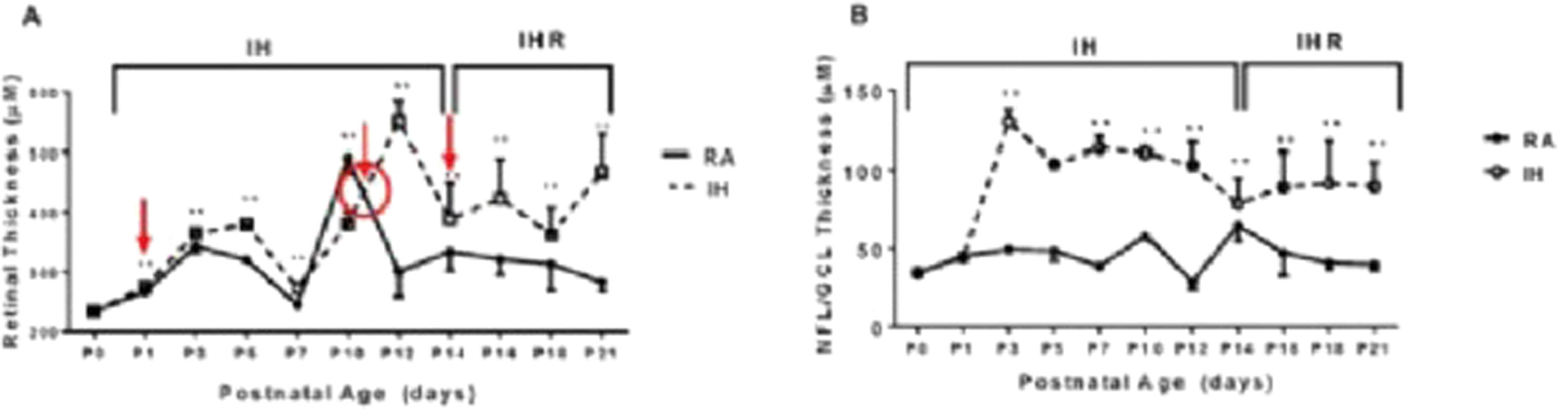 Postnatal temporal changes in thickness of retinal and nerve fi ber & ganglion cell layer in room air and Intermittent hypoxia