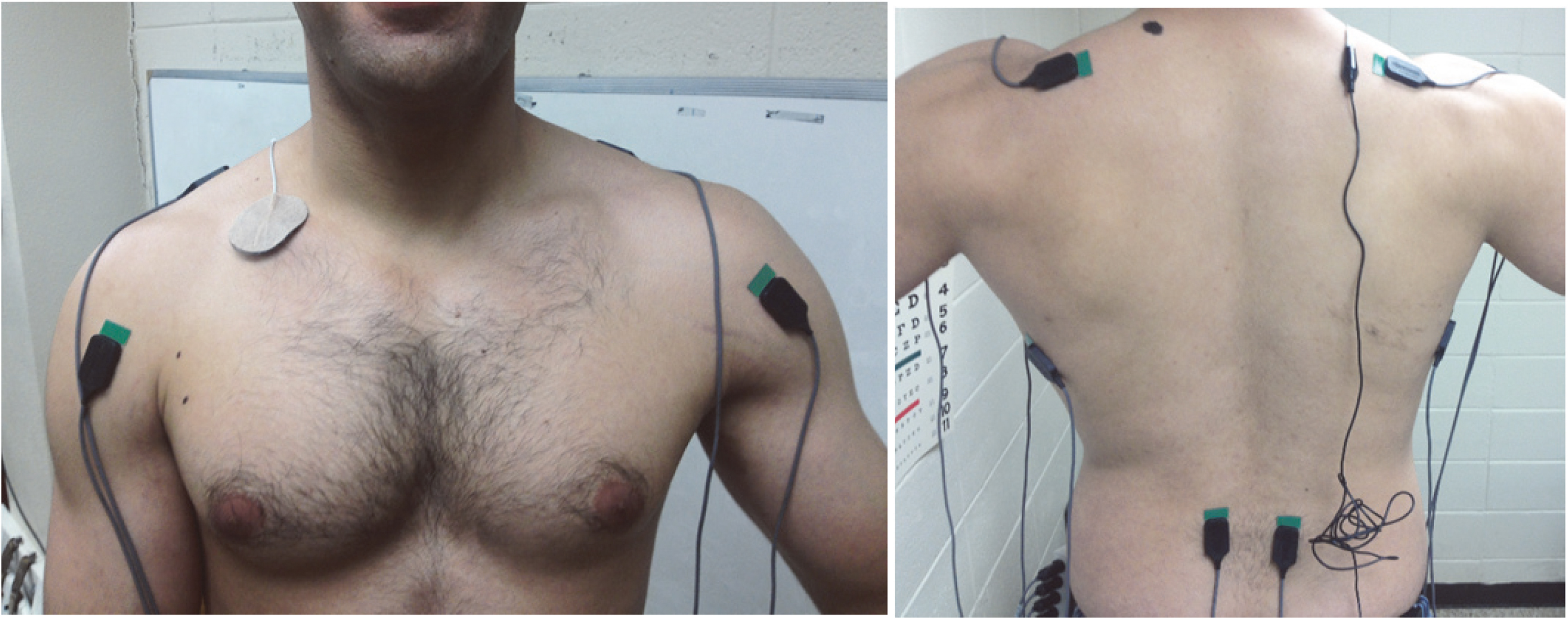 The exact location and positioning of each electrode for the anterior deltoid, trapezius, latissimus dorsi, and erector spinae (Konrad, 2005).
