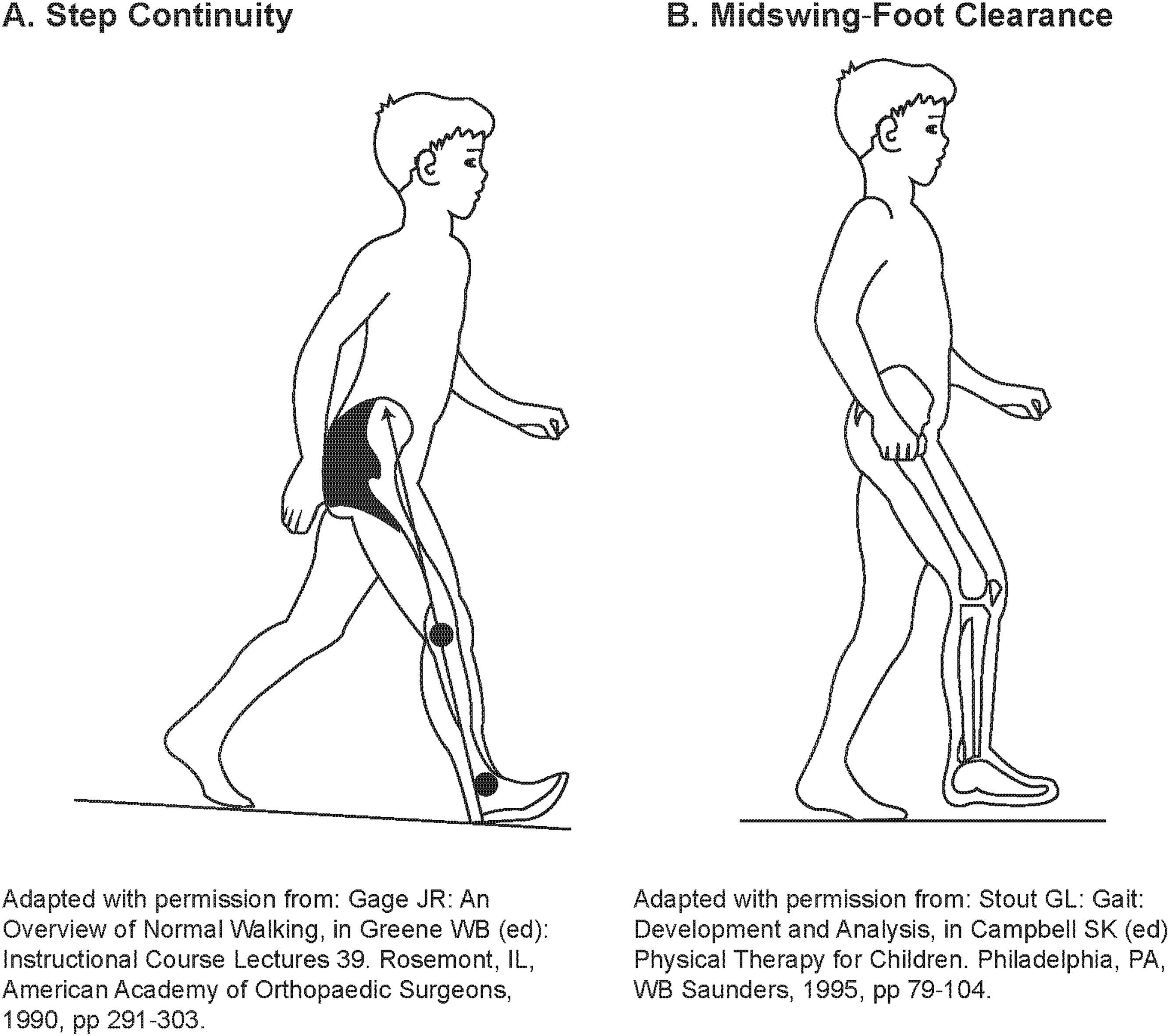 Example of step continuity and hip/knee flexion during swing for reference during rating. 