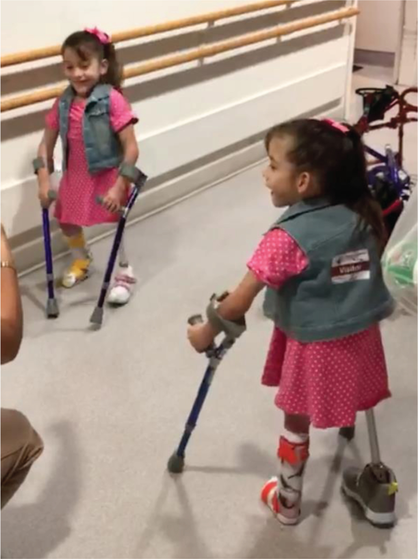 After several years with a walker, the twins progressed to using Lofstrand crutches. (Written photo consents obtained.)
