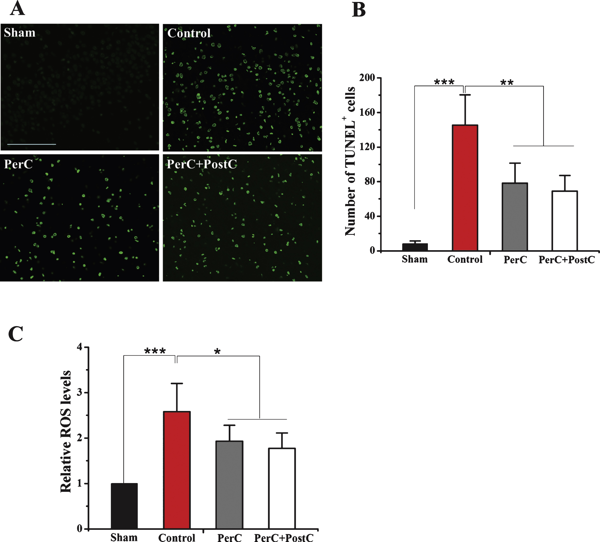 Effect of per-conditioning and post-conditioning on DNA fragmentation and intracellular ROS levels. A, Representative TUNEL staining at 3 days after reperfusion. Scale bar = 100μm. B, Quantification of average TUNEL positive cells number. **P <  0.01, ****P <  0.001. Error bars indicate SD. N = 5 per group. C, Relative ROS levels in each group. *P <  0.05. ****P <  0.001. Error bars indicate SD. N = 4 per group.